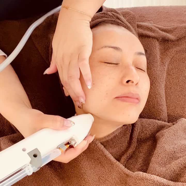 南早苗のインスタグラム：「金沢市東山にあるサロンへ。 Jamil Beauty Salon @jamil.beautysalon   今注目のヒト幹細胞培養液を使った施術。3回目です。 こんな風に空気の圧で肌へ注入していきます。 1回目の施術の時、 目の周りなど皮膚の薄いところに関しては 輪ゴムでパチンと皮膚を弾いたような感覚があるなぁと 思っていたのですが、、 回を重ねる毎に痛みが全然なくなりました！! 肌の状態が良くなっている証でしょうか！！？ (あくまでも感じ方は人それぞれですが)  中学校時代はソフトボール部で活動していたので、 太陽の光(紫外線)を浴び放題。。肌にはその名残が💦 当時は全くケアをしてなかったからなぁ。。 後悔先に立たずですが😅 この施術によって、少しでも肌がイキイキすれば いいなー😌  こちらは、医療クリニック提携サロンなので その点も安心ポイントですね✨ 初回は、5500円でヒト幹細胞フェイシャルも 体験できるそうです😊 女性だけではなく、男性の方も！ 気分転換にいいかも😌  詳しくは、 @jamil.beautysalon  を。  #美容　#エステ　#ヒト幹細胞培養液  #再生美容　#フェイシャルエステ #美容が気になるお年頃」