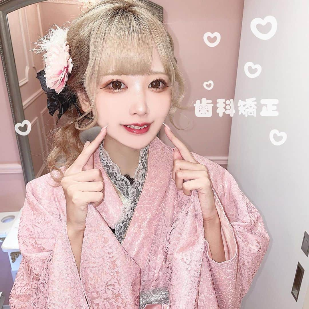 さきぼんさんのインスタグラム写真 - (さきぼんInstagram)「今日は銀座しらゆり歯科(@ginzashirayurishika )の日だよー！ 毎月歯列矯正のため通っています🦷✨  🎀7/12🎀 上のワイヤーだけ締めたよ～ マスクのうちに綺麗になりますように🥺🙏🏻  周りでもワイヤー矯正はじめてる人多いな～(まさかの推しも) みんなで頑張ろうね😭  ホワイトニングが2000円からできるコースもあるよ♡  破格なのでみんなもぜひ😳  しらゆり歯科は インビザラインや矯正治療がすごく得意だから 是非無料カウンセリングを受けてみてね。  歯科矯正が「さきぼんのインスタを見た」で10％オフになるよ😭💦 (ホワイトニング/セラミック/PMTC等も) →必ずお申し込み時に伝えてね( ´ • ·̫ • ` ) ※対象外の治療もあります。  ☎️ 0120-118-041 からカウンセリング予約できるよ！ . →銀座以外の医院でも割引適用します！  質問があればここにコメントください。できる限り答えます！   #銀座しらゆり歯科 #インビザライン #歯科矯正 #矯正 #矯正女子 #表参道 #精密審美会 #さきぼん矯正」8月11日 7時38分 - sakibon69