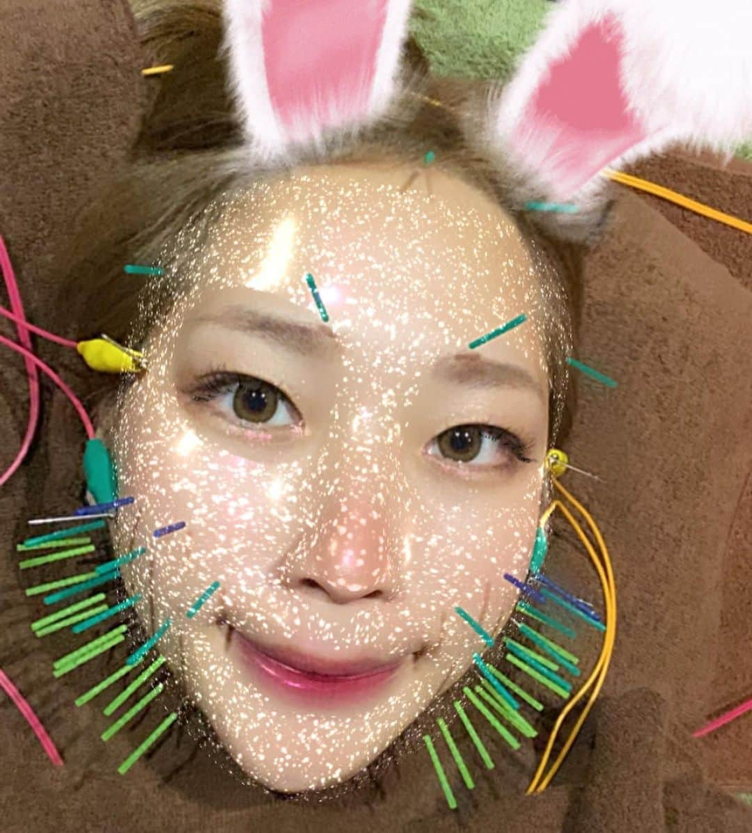 来栖あこさんのインスタグラム写真 - (来栖あこInstagram)「🐰 久しぶりの美容鍼🌈🌈 終わった後のスッキリ感が最高💕  いつもありがとうございます✨ お互い頑張りましょうねっ😎👍 #bcarat式美顔鍼 #bcarat @b_carat.bykoritorinic_rmc  @nakamura_rmc」9月3日 10時50分 - akopai.081