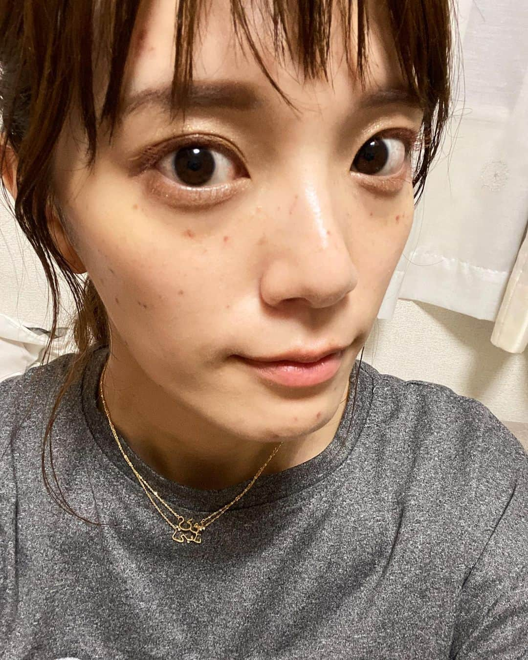 三谷紬さんのインスタグラム写真 - (三谷紬Instagram)「* ずっとずっと気になっていたそばかす。 実は撃退してきました🤭 撃退後3日目ですが現状かなり目立ってますよね。 これがいずれ剥がれて… おそらくそばかすが0になるはずです… また綺麗に剥がれたら皆さんにお伝えしたいです🥺 いつも必死にお化粧で隠していたので。 なくなるのが楽しみです！ * #ステマではありません#そのためどこでやったか言いません#ピコレーザー#ピコスポット#美容#そばかす#撃退#beauty#美容外科#美容好きな人と繋がりたい#美肌#目指せ#💸#未来投資#テレビ朝日#アナウンサー#三谷紬」9月3日 22時16分 - mitani_tsumugi