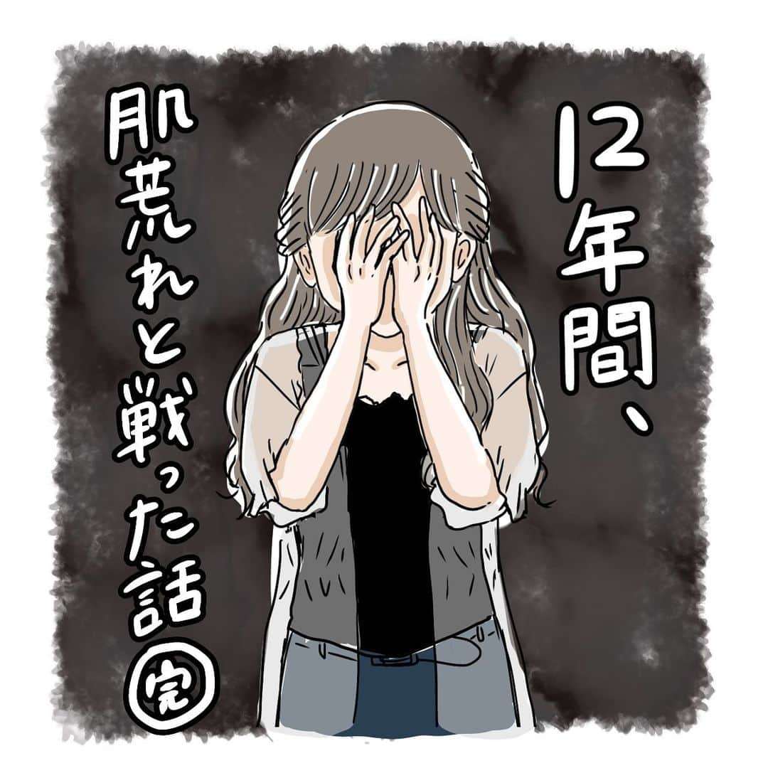 サヤカのインスタグラム：「これにて完結です！！  ⚠️8枚目実際の肌写真があります！ 大人になってからは少し落ち着いていたのですが、2年前になぜか急に酷くなり病みました😅 あまりの酷さにその時撮った写真が残ってたので、比較として載せました。  私はたまたまビオデルマというクレンジング水が合い、今はだいぶ良くなりました。  スキンケア方法は本当に千差万別ですが、きっと今悩んでいらっしゃる方にも、絶対に合うスキンケア方法があるかと思います。 諦めず、そして、今まで頑張ってきた自分を労ってあげてくださいね😭  前回postを見て、ビオデルマを買って下さった方達から「なぜか肌調子がいい！」と複数DMを頂いてます😭 もしここまでエッセイを読んできて、私と同じような肌質の方がいるのなら、試す価値はあるかと思います！ どうかどうか、皆の肌悩みがまとめて解決されますように！！！本当に！  それとビオデルマの使い方は色々あるかと思いますので、ご自身に合った使い方を見つけていただければと思います！ 例えば私は朝、水道水だけで洗顔するよりこれで拭き取る方が調子が良いのでそうしてましたが、気になるようならクレンジングとしてのみ or その後流してもいいです〜！  私はいつも楽天市場で買ってます🐰ハイライトの楽天ルームから飛べます！  こうやって商品名を出すとステマ？と思われてしまうかと思いますが、本当に本当にただのリピーターなだけで、ビオデルマさんとは何の関係もございません、、！🙇🏻‍♀️ 途中商品名を伏せようか迷ったのですが、ここまで描いといてそれはさすがに無いなと思ったのと、私が読者側だったら何が何でも知りたいだろうなと思ったので、紹介させて頂きました。  .  #イラストエッセイ #コミックエッセイ #実体験漫画 #実録漫画 #4コマ漫画 #インスタエッセイ #インスタ漫画 #インスタコミック #肌荒れ #肌荒れ改善 #ニキビケア #ニキビ #ニキビ肌 #コンプレックス #醜形恐怖症 #肌質改善 #スキンケア #肌診断 #すっぴん #クレンジング #ビオデルマ #ビオデルマクレンジングウォーター #ビフォーアフター写真 #オルビスユー #オルビス #ビオデルマサンシビオ #ニキビ治療 #肌荒れケア #ニキビ跡」