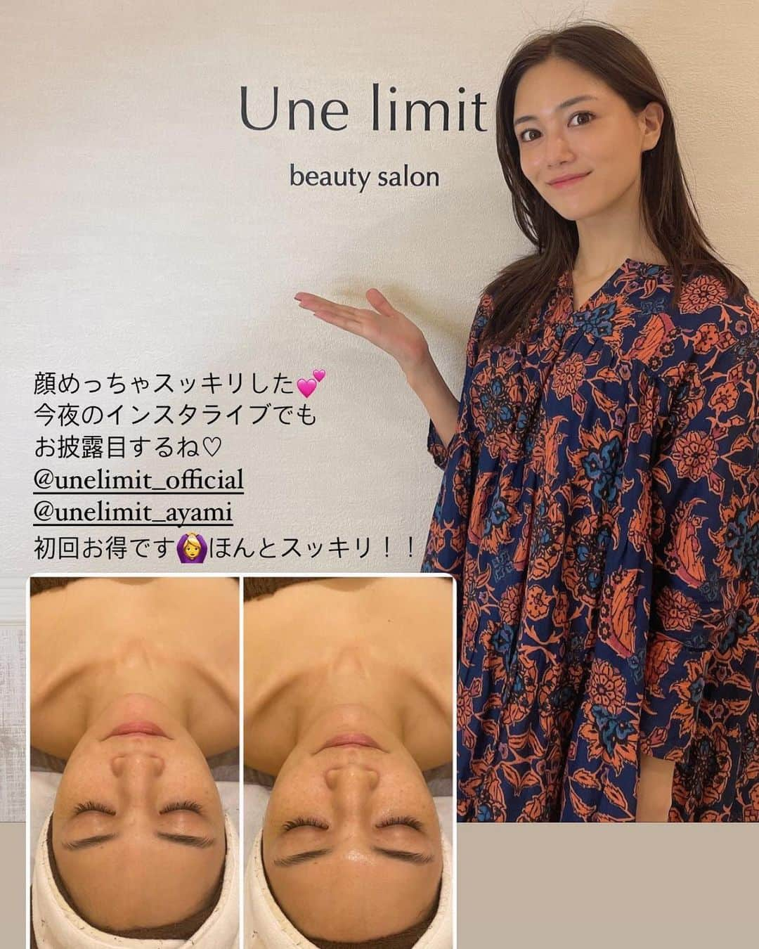 石井里奈さんのインスタグラム写真 - (石井里奈Instagram)「こんばんは❣️ . 先日の撮影メイク💄💕 秋になると暖色のメイクが可愛くなりますよね❤️ アイシャドウはオレンジブラウン、リップはマットなレッド、チークもブラウンオレンジのものでまとめてみました✨🧡 . ピアスは @wsp_pearl_official のバロックパールピアス💠✨ 前もここのパールのピアスつけててパールが綺麗で高見えして好評だったので今回も🙆‍♀️コロンとしてまるっとしてるデザインがぷっくりしてて可愛い❤️ . 撮影前に @unelimit_official でjetpeelしてもらってお肌も艶々でスッキリむくみもとれてデコルテも綺麗だったのでよかった〜❤️✨ 担当は @unelimit_ayami 🧡 . また更新します❤️ . #りなまるメイク #秋メイク #秋コスメ #カラーメイク #バロックパール #パールピアス #コーディネート #アクセサリー #デコルテ #秋カラー #ヘアスタイル #秋ヘア #パール #パールアクセサリー #jewelry #ジュエリー #パールジュエリー #ファッション通販 #小顔 #jetpeel #unelimit #むくみ解消 #むくみ #むくみ改善 #リンパドレナージュ #リンパマッサージ #デコルテマッサージ #フェイスライン #フェイシャルエステ #代々木上原」9月9日 20時27分 - ri7tin1025