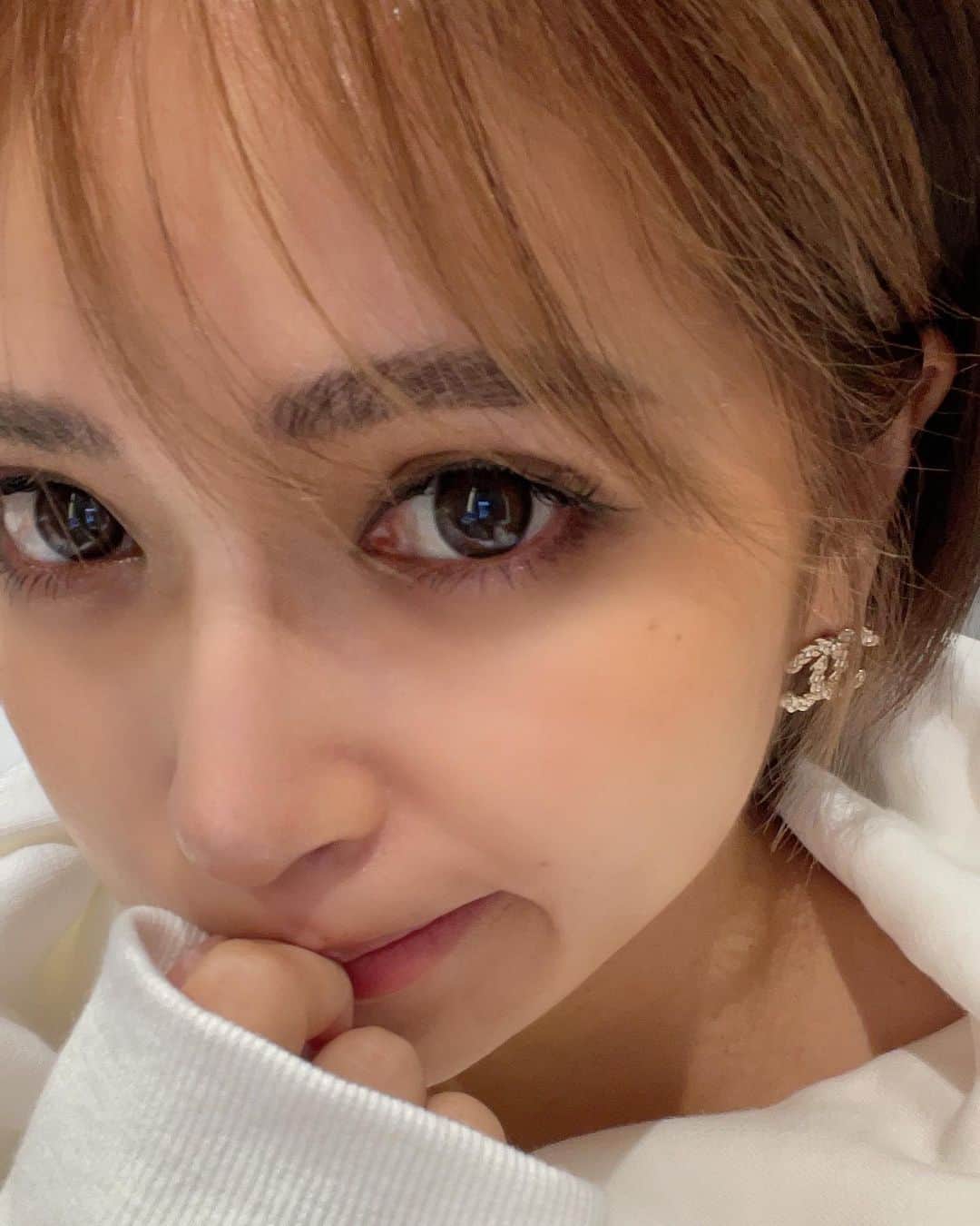 のインスタグラム：「2個目、お尻丸出し動画🐮 傷跡アートメイクに行ってきた動画！ 1枚目とりあえず顔入れといた。笑  1回も太ったことない若い時から おしり？太もも？にうすーくだけど肉割れがあって これって成長線なのかな🤔  傷跡アートメイクってゆう施術があるとゆうことを知って やってみようと思って今回は2回目  ちくちくちくちく痛いんだけど 我慢できない痛さではない！ 元々薄かったのもあるけどだいぶ目立たなくなったよー！！  若い時は若さでカバー出来たものが 今は、自分と向き合って身体も心も大切にしてる👏✨  傷跡、妊娠線にもおすすめなんだって◎ @dr.risakotomita 👩‍⚕️ @r_beauty.clinic 🏥」