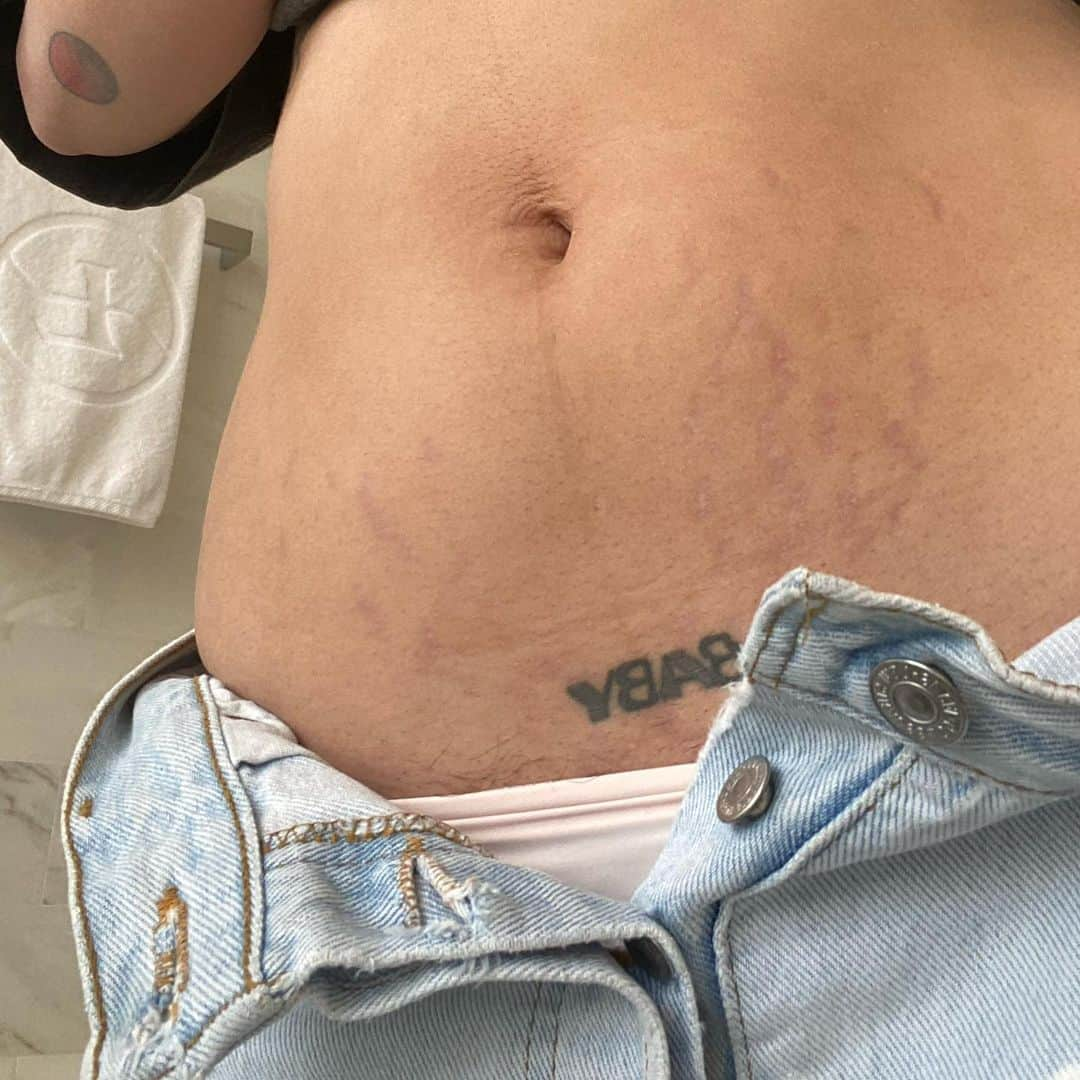 Halseyさんのインスタグラム写真 - (HalseyInstagram)「I am posting this because no matter what I do people are going to talk about my body. It is confusing symptom of being in the public eye so rather than complain I am going to give you something real to talk about! I did SNL two nights ago and a lot of people were quick to say how good I looked. That was a weird feeling. My body has felt like a stranger’s for a long time. I uphold myself to honesty to the point of over sharing sometimes but this feels important. The first picture on this slide is days after my baby was already born. A lot of people don’t know that you still look pregnant for a while after. It is still changing and I am letting it. I have no interest in working out right now. I’m too tired and too busy playing with my darling son. With that being said, the body behind all those compliments the other night was wearing a custom tailored outfit and lighted perfectly after much testing, so I could feel good and do my job. I do not want to feed the Illusion that you’re meant to feel and look “great” immediately postpartum. That is not my narrative currently. If you’ve been following me because you’re also a parent and you dig what I’m doing, please know I’m in your corner. I will never have my “pre baby body back” no matter how it changes physically because I have now had a baby! And that has altered me forever; emotionally, spiritually, and physically. That change is permanent. And I don’t want to go back! But In the spirit of honesty, I’m really tired and not a superhuman and this is really hard. Doing my best to serve my art and my family whilst keeping it all so very real. Love.」10月12日 1時07分 - iamhalsey