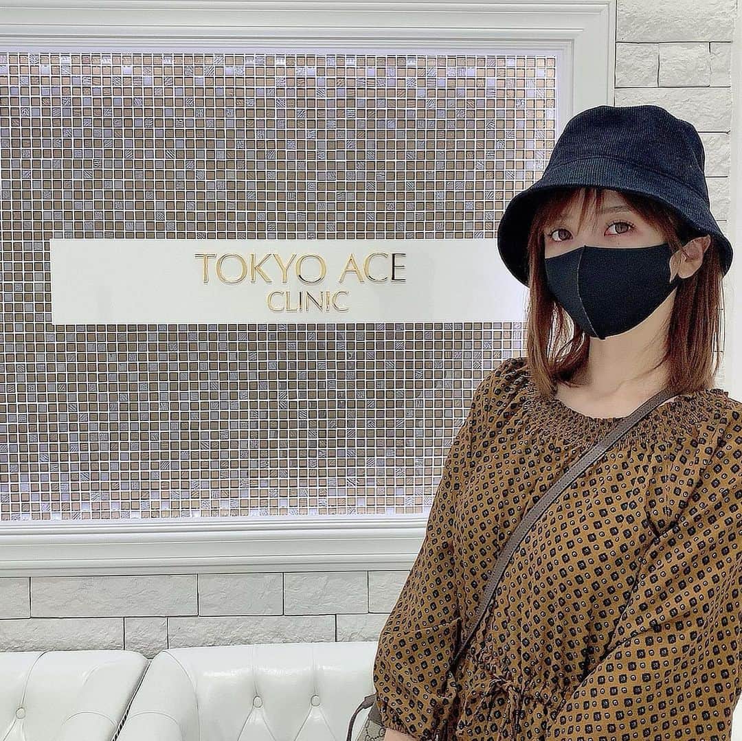 大槻ひびきさんのインスタグラム写真 - (大槻ひびきInstagram)「TOKYO ACE CLINICさん (@tokyo_ace_clinic)で フォトフェイシャルしてきました🌸  毎月通っていて 先月より肌のトーンが 明るくなってきた✨ お肌の悩みも減ってきています😊  施術時間は 洗顔やメイク直しの時間含めて 40分くらいです🥳 照射中眩しさはありますが アイガードするので安心⭐️ 光を当てるだけなので痛みも少ないですし 私は赤みはすぐに消えました😊  ありがとうございました🌸 次回もよろしくお願い致します✨  #tokyo_ace_clinic  #beauty  #フォトフェイシャル」10月13日 3時02分 - yanhibi0221