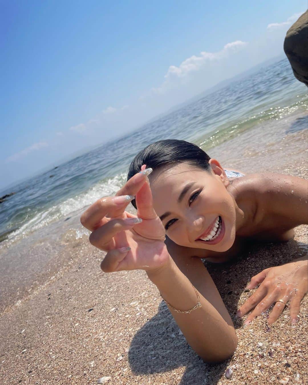 のインスタグラム：「. やっほゆみだよ🐚🏖💕 やっと秋っぽい空気になってきた頃かな？強烈な紫外線もマシになったかなと思い、フラクショナルレーザー2回目して来たよ😉💉 相変わらずの痛さでした💉😆 @shibuyamori で今回も施術してもらいました👨🏻‍⚕️🔥 ダウンタイムもあるし痛みもあるけど効果を期待して👏💕 美容の日が一番楽しい🥰🥰🥰 痛々しい顔もストーリーあげてくね🤪💉 . . #渋谷の森 #渋谷駅 #整形外科 #美容整形 #美肌 #フラクショナルレーザー #レーザー #毛穴 #アンチエイジング」
