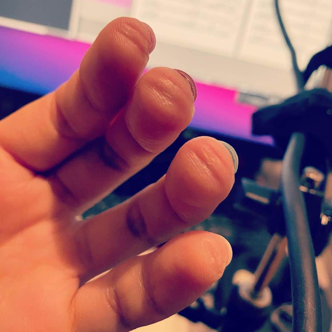森恵さんのインスタグラム写真 - (森恵Instagram)「12弦はこうなる。 もう痛くはないけどな。  #と、LINEでスタッフにタメ口で送ってしまいました。 #12弦 #アコースティックギター #guild」10月17日 18時03分 - morimegumi_official