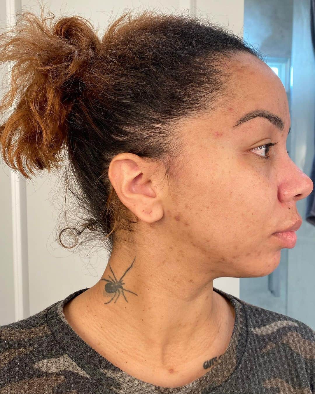 Brittany Rennerのインスタグラム：「My before and after using @glowskinenhancement’s glow UP face kit. I felt so fugly without makeup and now I feel my most beautiful in my natural state!!! I don’t care if you don’t like me but you should at least like your face enough to give it a try 😁」
