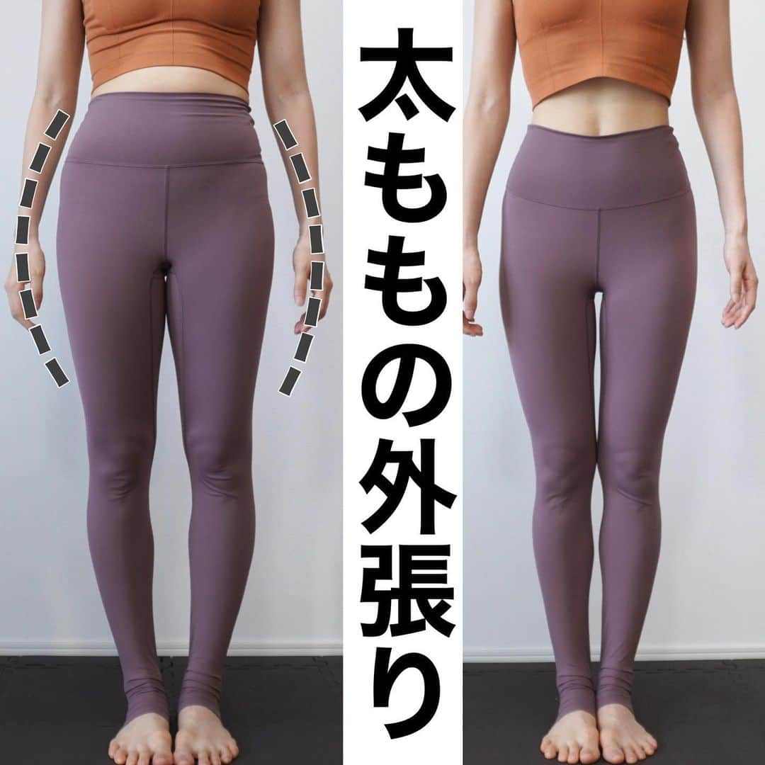佐川裕香のインスタグラム：「\太ももの外張り解消/  左はスウェイバック姿勢、右は正しい姿勢 姿勢によって見え方だけでなく身体への負担も大きく変わります🏃‍♀️  見せ方や姿勢で変わるならエクササイズやストレッチは必要ないのでは？  ですがまず右の姿勢を取れない、良い姿勢が間違ってる場合が多く 次にその姿勢を維持できないという事がほとんどです..  筋力が不足してると外の方で負担をかけてエネルギーを使いがちになります （左の状態がイメージ） するとももやふくらはぎの外が張りやすくもなりますね💦😭  身体の使い方を知る、無意識のうちに身体のアライメントが整っていて良い姿勢の状態をつくる為にはやはりストレッチ&エクササイズ、身体の使い方を知る事が必要だと身を持って感じております‼️  ▶︎回数　10〜30回　 YouTube 反り腰改善、HIPDIPSシリーズ、股関節ストレッチ  四つ這いエクササイズのポイント☝︎ ①胴体、骨盤を安定させて股関節から動かします ②はじめは小さく動かします ③腰が反りすぎないように注意  本日YouTubeに20時アップする動画は 立ったままお腹、背中を特に引き締められるおすすめ動画です❤🙇🏻‍♀️  ▶︎効果を上げたい方はオンライン、対面レッスン ・水曜　上半身　 ・金曜　下半身 ・土曜　コア　  ・対面レッスン　川口クラス 毎週火曜、金曜」