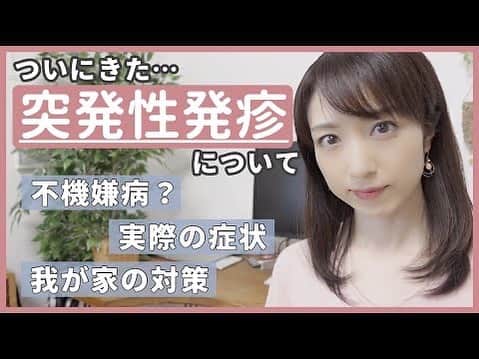 のインスタグラム：「1ヶ月ほど前ですが、息子が突発性発疹にかかりました。うちの子の場合の症状など、YouTubeで共有いたします。 プロフィール欄からどうぞ👆  #突発性発疹#1歳」