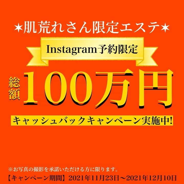 肌質改善専門サロン~Accueil~のインスタグラム