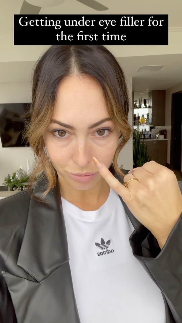 ホープ・ビールのインスタグラム：「Y’all I did it, after complaining for years about my under eye bags I finally let @illest.injections @itsasecretmedspa work her #magic  . You guys know that I’m transparent about what I do to my face. I have been doing Botox for the past two years and I’ve been filling my lips for the past five years. I know doing something like this can be scary so I figured I would show you the process, it was actually painless and  I am so happy with the results!  I can’t believe I waited this long.  . By the way I am not saying this is something you SHOULD do I’m just saying do what works best for you and whatever is going to make you happiest.」