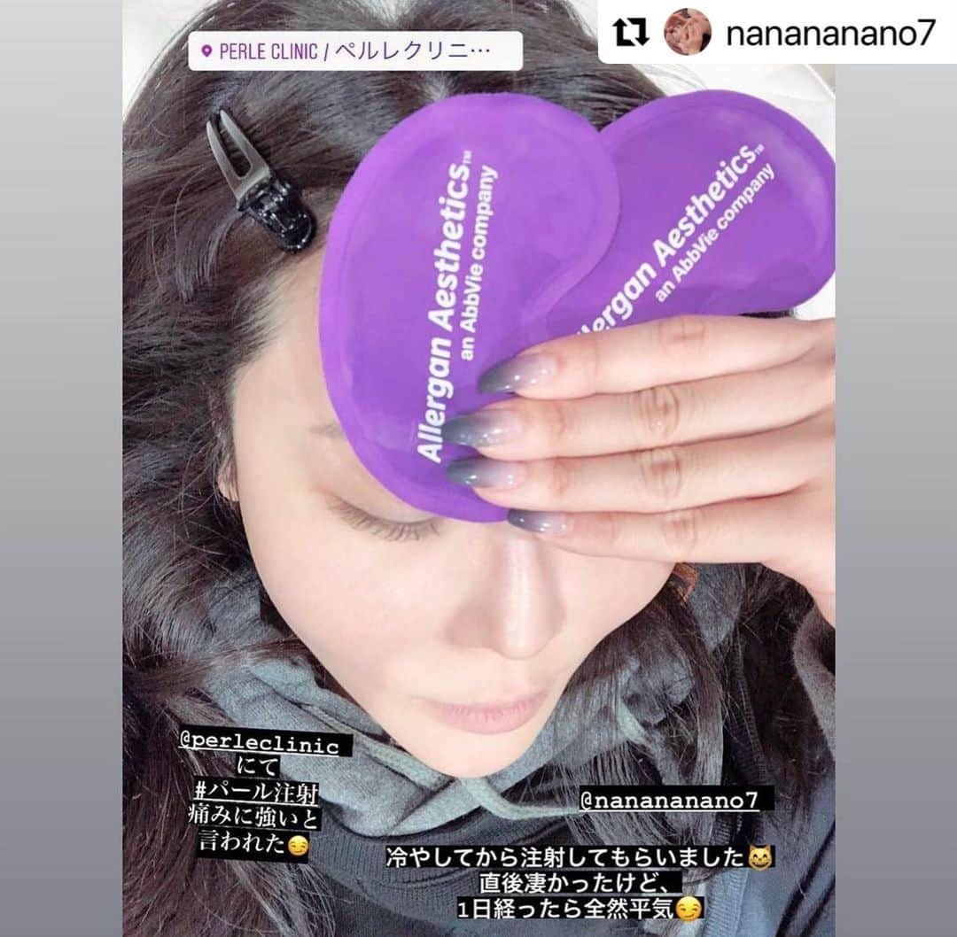 七菜乃のインスタグラム：「#Repost @nanananano7 with @make_repost ・・・ @perleclinic  にて、 #パール注射  前カウンセリング行った時、 絶対おススメと言われたので それは絶対せねばということで、  #細胞移植 #培養移植 ちょうど1ヶ月後の昨日に 注入してもらってきました💜 (1ヶ月から注入系ok 3ヶ月後からレーザー系ok と言われていて、3ヶ月待つの辛い笑)  痛かったけど、 私は耐えられる痛みです😂 美容鍼だと脳内変換させてる😏  直後ボコボコになるのは クリニックのインスタや @dr.satomi  先生のインスタを見てたので分かってたから テンション上がっていっぱい写真撮った😂  夜オンラインイベントだったけど、 大丈夫でした😂 3時間くらいでボコつきは おさまりました！  1番水光注射が痛いと思ってるんだけど、 それに比べたら大丈夫だったし、 的確に注入されてるのがわかるから ボコつきよありがとうございます💜 となりました😂  1日たった今は ちょっと赤みとかあるけど、 全然すっぴんでも大丈夫です😏  肌質どうなるかな。 楽しみ💜  #美容アカウント始めました  #美容アカウントさんと繋がりたい  #美容アカ #美容医療 #肌の若返り  #美肌になりたい #美容は継続 #美容医療  #ボトックス  #ボトックスリフト  #ペルレクリニック  #ヒアルロン酸 #ボトックス #成長因子 #美肌になりたい」