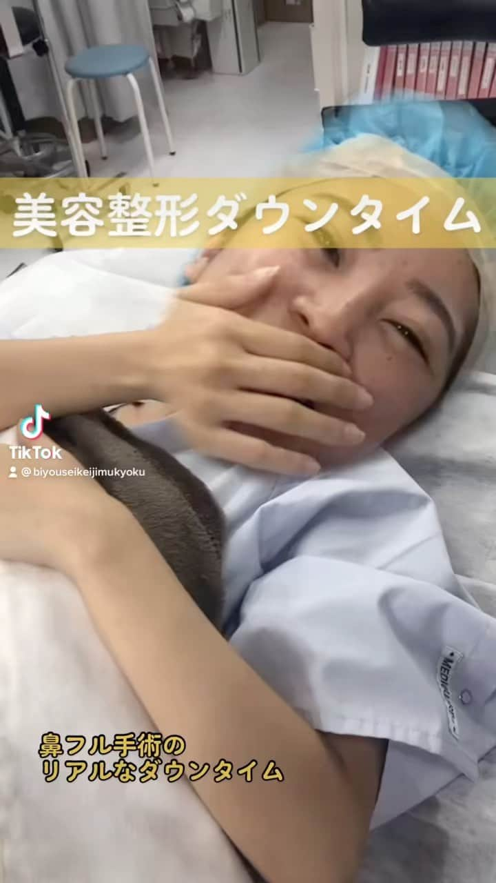 東京美容外科公式のインスタグラム：「スタッフモニター② 鼻フル手術のリアルなダウンタイム ➖➖➖➖➖ 🗣お問い合わせ ➖➖➖➖➖➖➖➖➖➖➖➖ 🤳🏻フリーダイヤル 0120-658-958 電話受付時間：9：00～21：00 ❇️LINE予約 @ tkc110 ✉️メール プロフィールのURLから公式サイトへ 🔻🔻🔻🔻🔻🔻🔻🔻🔻🔻 📱無料WEBカウンセリング実施中！ 自宅からLINEのビデオ通話でドクターにご相談いただけます。WEBカウンセリング希望とお申し付けください🙇‍♀ ➖➖➖➖➖➖➖➖➖➖➖➖ #東京美容外科 #美容外科 #豊胸#シリコン豊胸 #ベラジェル #デュアルプレーン豊胸 #バストアップ#育乳#美バスト#バスト#美容整形#整形#Twitter企画#V3#ファンデーション#フェスリフト#症例#美容整形＃鼻フル#スタッフモニター」