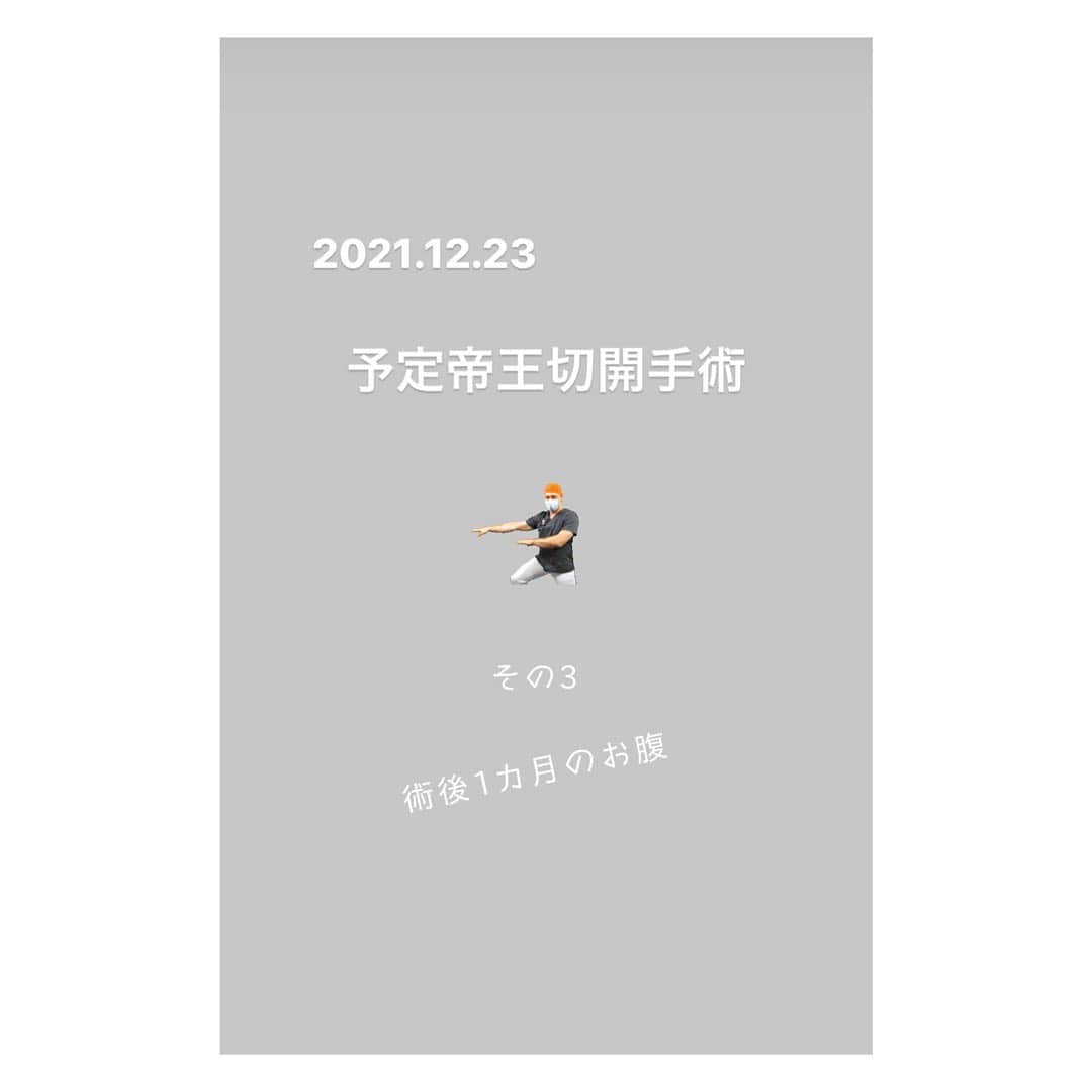 笹峯愛のインスタグラム：「手術中、出血に伴い 冷える身体で朦朧としつつも  A先生が、執刀医B先生に 「おぉ、すごい！さすが！！」 と絶賛する言葉を耳にして  何やらうまくいった様子…と、意識を繋ぎ止めておりました。  貧血っぽいと言う私に A先生が素早い対処をしてくださり 私の頭もしっかりしてきた頃  B先生の腕前により出血も治った模様。  看護師さん達が 「せーっの！7」とか 「せーっの！5」とか とユニぞる声が聞こえております。  …いっせーのせ！でもやってます？ ←そんな訳ない。  しばらく考えながら 看護師さん達の「せーっの！…」を聞いていたのですが、閃きました。  ガーゼの数を確認しているんだと。  使用した数と お腹から取り出した数とを 合わせているんですな、たぶん。  これ〝せーっの！5〟と〝せーっの！4〟で数字合わなかったら バタバタして大変なんだろうなぁと、めちゃくちゃ他人事のように考えていましたが 1番大変なのは、私じゃない？と今なら思う次第。  そこからは、ほのぼのとした会話に戻った手術室。  A先生「これ、誰だっけ」  話題は再び、流れているCDの曲に。  B先生はわからない 看護師さん達も思い出せない  私も…なんだっけ？誰だっけ？ 歌える。ソラで一緒に歌えるのに、アーティスト名もタイトルも出て来ない。  はい、そう言うお年頃。  手術は順調に進み A先生がB先生に 「綺麗にしてあげましょうよ」 と縫合についてコメントしておりました。  第一子の帝王切開跡が 少しケロイド状態になっていたので その辺りの処置かしら…と思っていた私の脳裏に一筋のワードが。  「コブクロ！」  目の前のピンポンを押したかの勢いで 先程、思い出せなかったアーティスト名を発しておりました。  私の突然の発言に 一瞬〝え？〟と言う間が空いたものの  A先生が 「そうだ！コブクロだ！！」 と乗っかってくれて  看護師さんの 「今の三浦さん（が言ったの）？」 と言う問いかけで  とにかく大人しく余計な邪魔はするまいと 勝手に距離を取って蚊帳の外気分でいる私も、ついに何やら一体感。  曲は最後のサビ、大盛り上がり。  全員、そうだそうだコブクロだ とスッキリした気分で  パチンパチンとお腹を閉じるホッチキスの音も 更にリズムを増し軽快に、和やかムードは最高潮の中  私の帝王切開手術は幕を閉じたのでした。  …そして、そこから  麻酔で下半身どうにもできない私は 手術台から衣服を広げたストレッチャーに移され まだまだ、あれよこれよとなすがまま。  廊下で心配そうに待つ旦那に対して コブクロで変なテンションなだけで 麻酔で痛みもなく、大仕事終えた感もない私。  保育器に入っている娘と記念写真を撮り、余裕の状況でしたが  この後一晩  麻酔が切れた後、傷なのか子宮の収縮なのか 何の痛みなのかわ分からない孤独な戦いを乗り越えます。  お股から出る悪露の確認。 痛み止めの座薬。  手術前から〝恥じらい〟と言う概念は無くなったと思っておりましたが 痛みを伴って、更に輪をかけて何かを捨てて行く一晩となる訳です。  病院のベッドで天井を見上げながら こうして〝母〟になっていくのね…と思ったものですが  意識して〝女〟を取り戻さねば…と思う産後1ヶ月。  衰えない食欲と、産んだはずなのに まだへこまないお腹との戦いは続く。  #帝王切開 #手術 #出産 #産後」