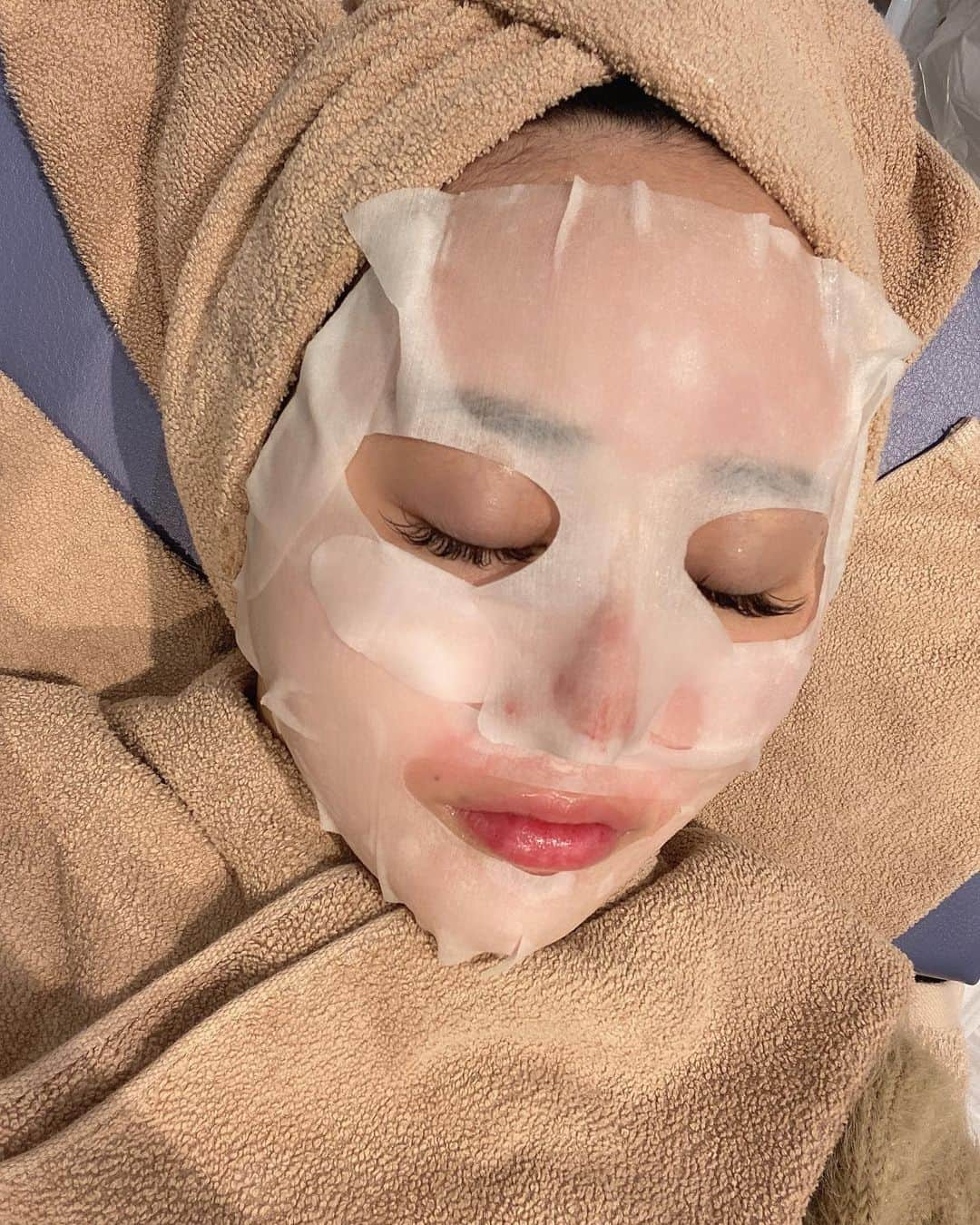 SHIHOさんのインスタグラム写真 - (SHIHOInstagram)「. . #beauty 🤍🤍🤍🤍🤍 . . (( @venus_beauty_clinic )) . ヴィーナスクリニックで7回目の ダーマペンをしてきました✨！ . . . アンチエイジングや再生治療に効果的なの(*´───`*)✨ . ニキビ跡やニキビを改善して 美肌になるために💓💓💓 . . 前にやったときちょー感動して😭💓 今回はダウンタイムをしっかり取れたから 気になるニキビ跡のところを少し深めに 刺してもらったから赤みが強い😗👍 . . 麻酔クリームをするから痛みはなかったです😍 . 2、3日は赤みが出るみたいなんですが お肌がほんっとにつるっつるに なるから毎回楽しみだ〜っっ🥳💋 . . @venus_beauty_clinic  ありがとうございました🤍🤍🤍 . . . #venusbeautyclinic #venusbeauty #clinic #美肌ケア #美肌 #スキンケア #美白ケア #毛穴ケア #ダーマペン経過 #ダーマペン治療 #ダイエット #トレーニング #尻トレ #自宅トレーニング #ヒップアップ #ファッション #楽痩せ #バストアップ #バストアップメニュー #バストアップ成功 #ダイエットメニュー #酵素ドリンク #酵素 #着圧ソックス #メイク #ランジェリー #diet #bodymake #training」1月9日 19時55分 - cham_pipi