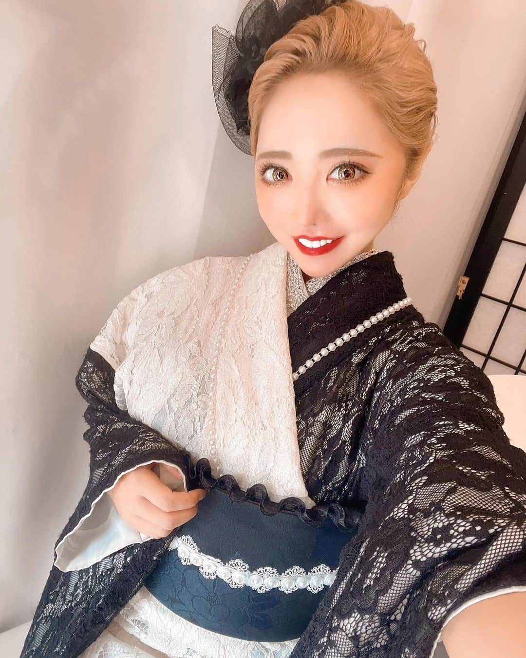 とみmamaのインスタグラム：「@a_clinic_ginza で 戸田先生　@aclinic_toda に Aスレッドやってもらってから 2週間が経って 輪郭が更にシュッとしてきたー🥺💓✨！ (２枚目がビフォーアフター)  術中も麻酔以外は全く痛みもなかったし どんどん馴染んで腫れも引いてきて (と言っても麻酔の浮腫みが徐々に引いてった感じで 腫れ自体はほぼ腫れなかった。🤷🏼‍♀️)  顔周りのもたつきとか弛みもほうれい線も無くなってくれて 本当に嬉しい🥺💓💓  亮太からも"なんか顔シュッとした？" って言われたよ🥰  小顔にしたい方にはもちろんだけど 私みたいに輪郭はあまり変えずに 弛みやほうれい線だけナチュラルに引き上げない って方にも本当おすすめだし リフトで良い先生見つから無いって方には 本当に戸田先生ゴリ押しします。笑  #aスレッド #糸リフト #aclinic #aclinic銀座 #aclinic横浜 #aクリニック #エークリニック#美容 #小顔 #美肌 #リフトアップ #美容外科 #美容皮膚科 #美容クリニック#戸田貴之」