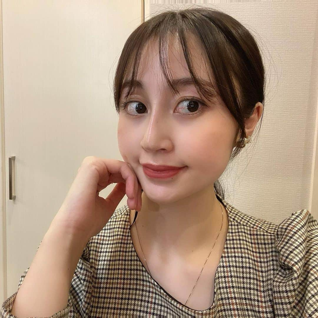 小森美果さんのインスタグラム写真 - (小森美果Instagram)「こないだ#東京中央美容外科品川院 @tcb_shinagawa で#tcbメッシュ の2週間経過観察に行ってきました🐰 鼻筋めちゃくちゃ綺麗になった✨もう腫れもなく痛くない❕ 塩満先生 @tcb_shiomitsu  にやってもらいました🤍　 やって良かった🐰 #鼻整形ならTCB東京中央美容外科 #品川院#塩満恵子 #美容整形ならTCB東京中央美容外科 #東京中央美容外科#美容外科#美容クリニック#美容医療#TCBメッシュ #鼻整形#PR #東京中央美容外科品川院 #TCB」2月1日 19時45分 - mika.165