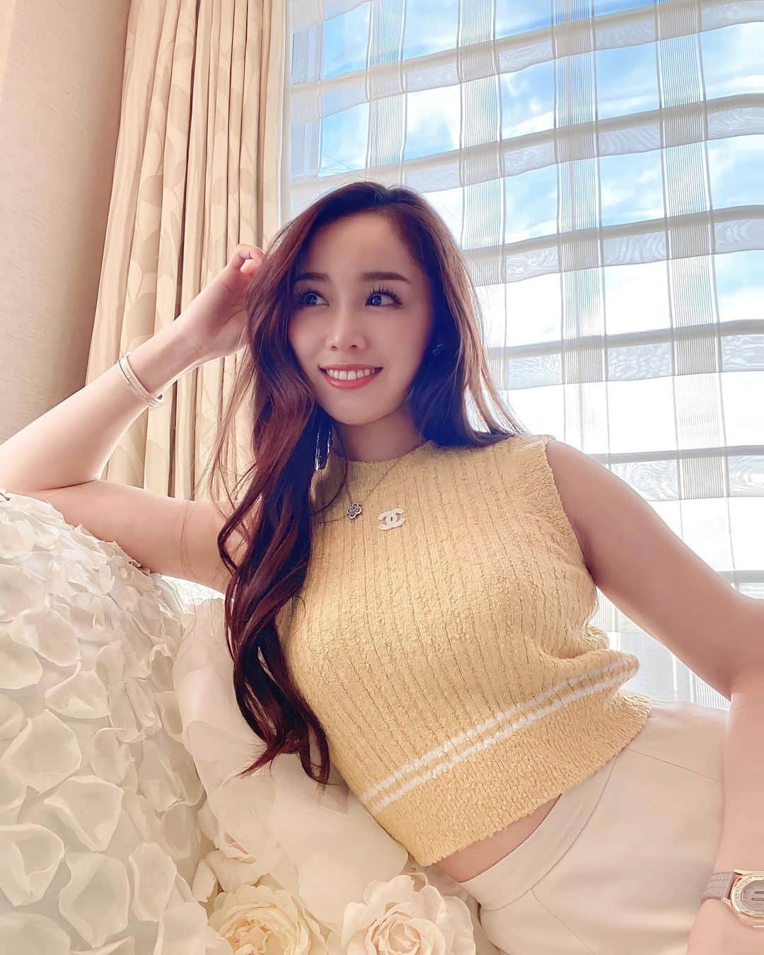 石田安奈のインスタグラム：「𝑩𝒆𝒂𝒖𝒕𝒚 𝒅𝒂𝒚💕✨  経過投稿✨ 先日 @a_clinic_ginza の　@aclinic_toda 戸田先生に1day小顔脂肪吸引をしていただきました❤  写真の通り、フェイスラインが全然違う🥺 もう既に二重アゴにもならないので嬉しい😭❤️  術中の痛みは全くなく腫れも2日目に少し赤みがあったけどファンデーションで隠せるくらい♡  施術後は無意識にフェイスラインを触りたくなってしまうのよね🤤周りからも本当に顔が小さくなったね！と言われて嬉しくて♡  ビフォーアフター見てもVラインの出方が全然違う🥺  メイクで小顔に見せる事も可能だけど普段からフェイスラインのたるみなど気になる方にはとてもおすすめだなぁと思いました🥺✨ なんせ、ダウンタイムがないので時間のない方にも！ 次はピコトーニングで妊娠中にできたニキビや肌荒れのケアしたいなぁ♡  #aclinic #aクリニック #エークリニック #aclinic銀座 #aclinic横浜 #美容外科 #美容皮膚科  #1day小顔脂肪吸引 #1day小顔 #脂肪吸引 #小顔 #美肌 #二重あご #フェイスライン  #糸リフト #aスレッド #顔痩せ #部分やせ #小顔整形 #小顔になりたい #横顔美人 #戸田貴之 #aclinic新宿」