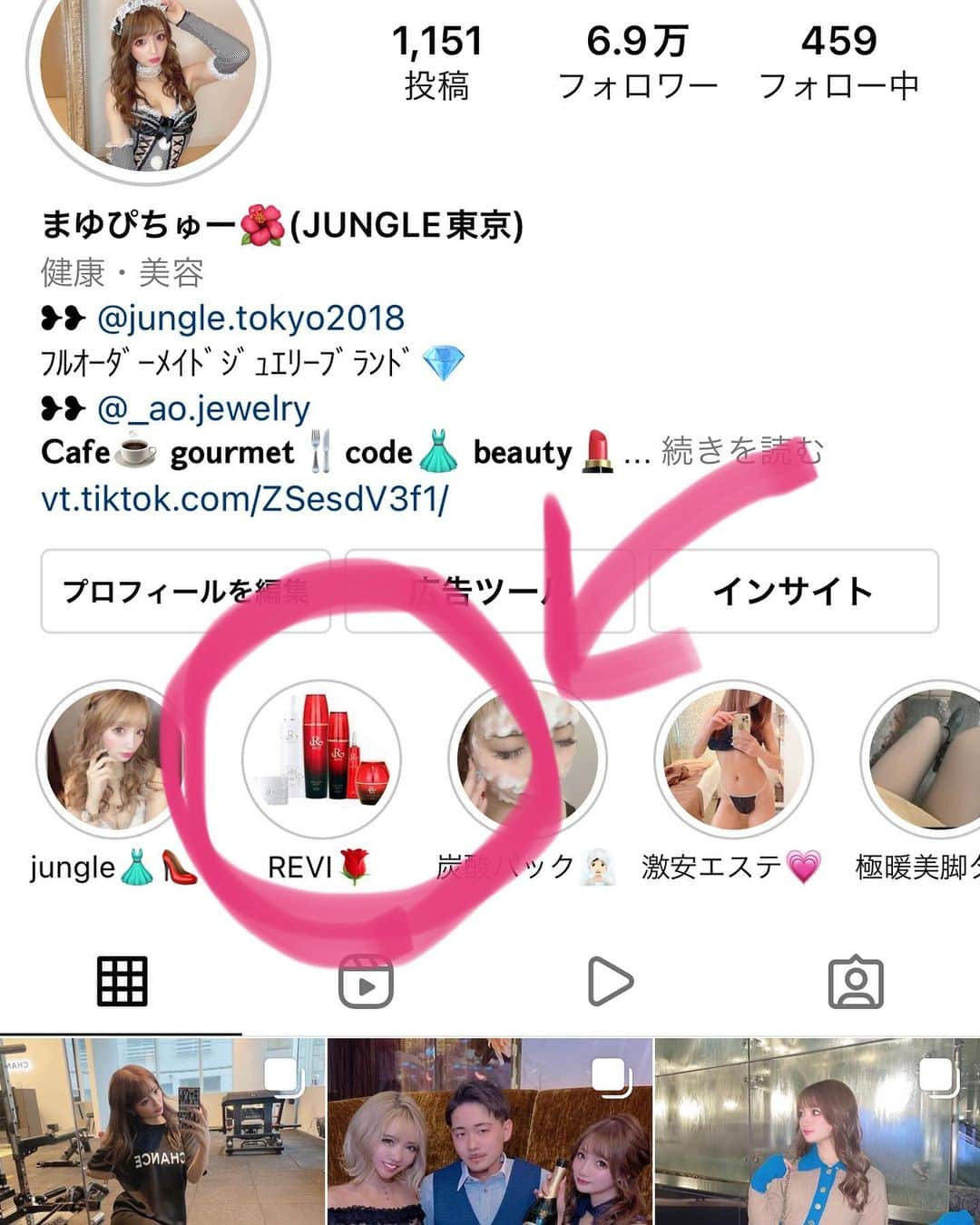 まゆぴちゅーさんのインスタグラム写真 - (まゆぴちゅーInstagram)「お肌メンテナンス🧖🏻‍♀️💋✨  月1で通ってる東銀座駅から徒歩1分の 銀座メディック @ginza_medic 🤍💎✨  大好きなベテランエステティシャンの ゆみ先生 @yumisensei_430 のゴッドハンド 施術を受けにまた行ってきたよーん🤤❤︎  REVIの陶肌トリートメント⭐️ ハーブピーリングもあるフルコース🌿💓💓  優しくクレンジングや洗顔、からの ゆみ先生の気持ち良すぎるゴッドハンドマッサージ で顔首肩をほぐしてもらって、  筋膜リリースからの7,000ショットの めちゃいい機械でのハイフでリフトアップ⤴︎❤︎  このハイフは目元のキワも、 小鼻にも当てられるからすごい！！✨✨  からの大好きなREVIのハーブピーリングは 酵母と植物幹細胞、国産ハーブのみを ブランドした、剥離しない、痛みもない ものだからお肌が弱い人にもおすすめ😴🤍🤍  肌細胞、肌本来が持っている力を 活性化させてくれて、ニキビ跡にもいいし、 毛穴レスな美肌に導いてくれるの😭💓✨  かれこれこのトリートメント4回目？とかに なるけど通うたび肌の状態良くなってて、  肌触りも変わったし(ツルツル滑らか！)、 顔も引き上がった気がするし、 炎症ニキビは0になって、ニキビ跡も減った！！ 本当に出会えてよかったサロンと、 REVIのホームケア。  REVIはすごいよ。まじで。 エステで導入されるだけある😭😭🤍🤍🤍 ホームケア商品はプロフのハイライトにも 書いてあるからぜひ見てみて欲しい！！！！ . . ゆみ先生のトリートメントコースは、 肌施術だけじゃなくて、 小顔矯正、頭蓋骨連動矯正までしてくれて 美肌＆小顔が手に入るし気持ち良すぎておすすめ💋  ここのサロンで使ってる“磁気ベッド”も オリンピック選手も使うレベルの ハイレベルなやつで効果あがるしね🥺✨✨ @sokenmedical  . . お肌悩みや身体悩みがある方は、 ぜひゆみ先生にDMしてみて欲しいです💌♪  ▶︎ @yumisensei_430  . . 1枚目の写真のバッグは @_coco_vintage_ の可愛いバッグだよ🖤🥰  5枚目の動画でお肌の調子良すぎる のを見てくださいまじツヤ増した🥲❤︎ . . . #ハーブピーリング #小顔矯正 #頭蓋骨矯正 #REVI #reviハーブピーリング #剥離しないハーブピーリング #東銀座 #東銀座エステ #美容エステ #磁気ベッド #ルヴィ #銀座エステ #毛穴レス肌 #毛穴ケア #ニキビケア #ニキビ肌改善 #ニキビ跡改善 #ハイフエステ #ジャングル東京 #JUNGLETOKYO」3月2日 18時39分 - mayu_03pichu