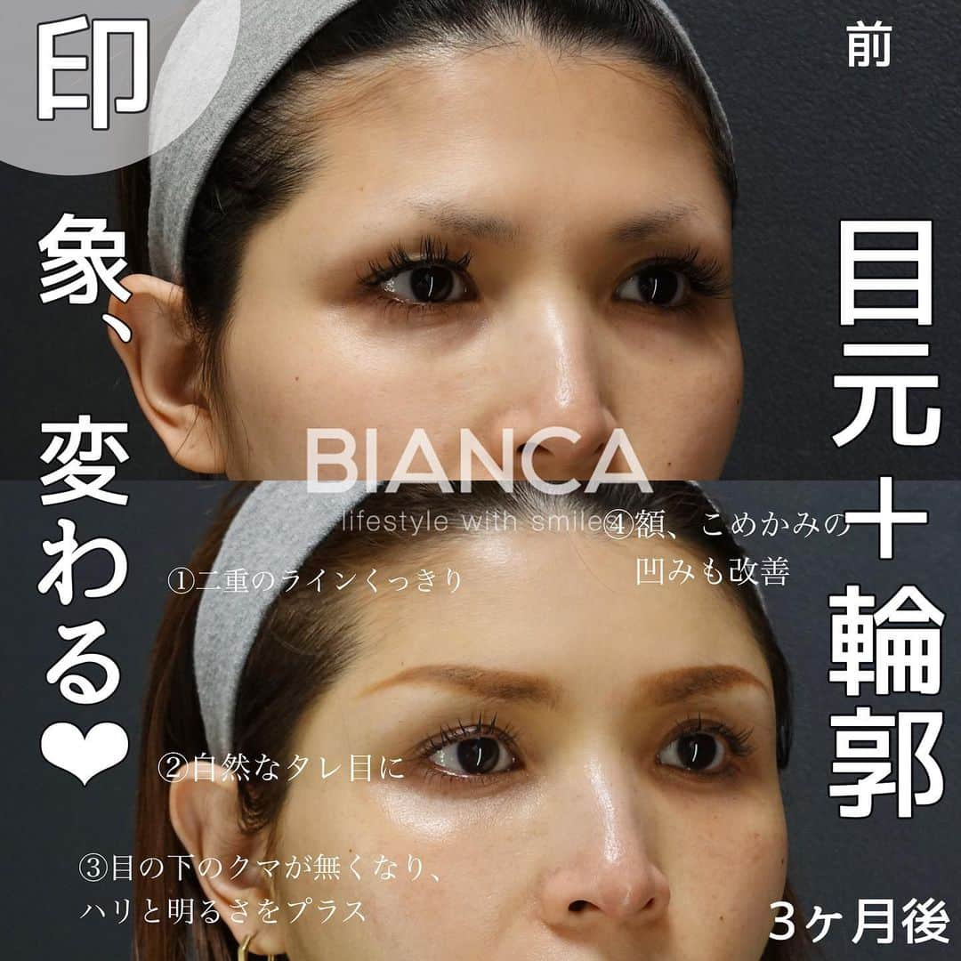 辻沢由有（BIANCA CLNIC 表参道院 院長）のインスタグラム