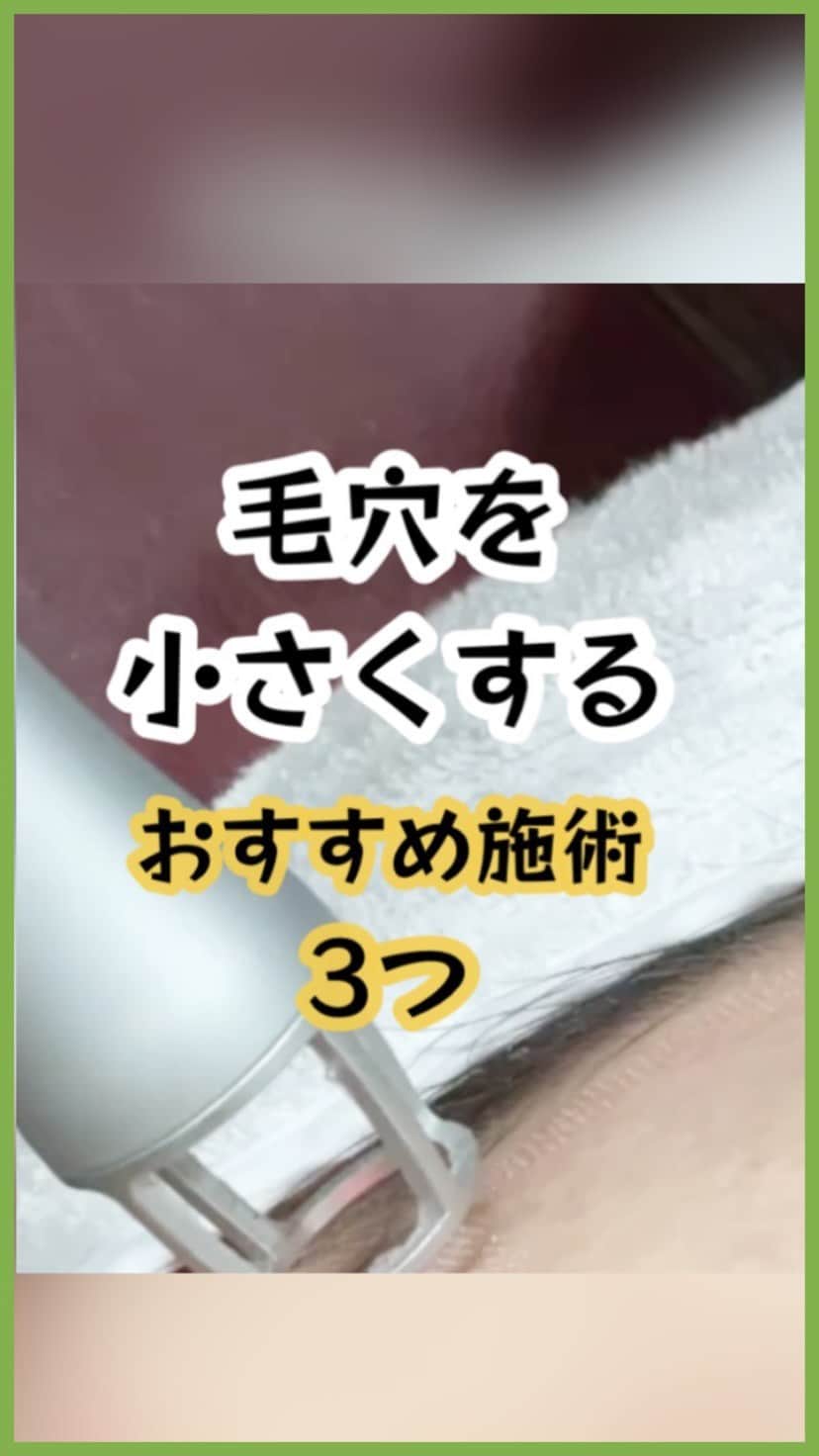オラクル美容皮膚科東京新宿院のインスタグラム