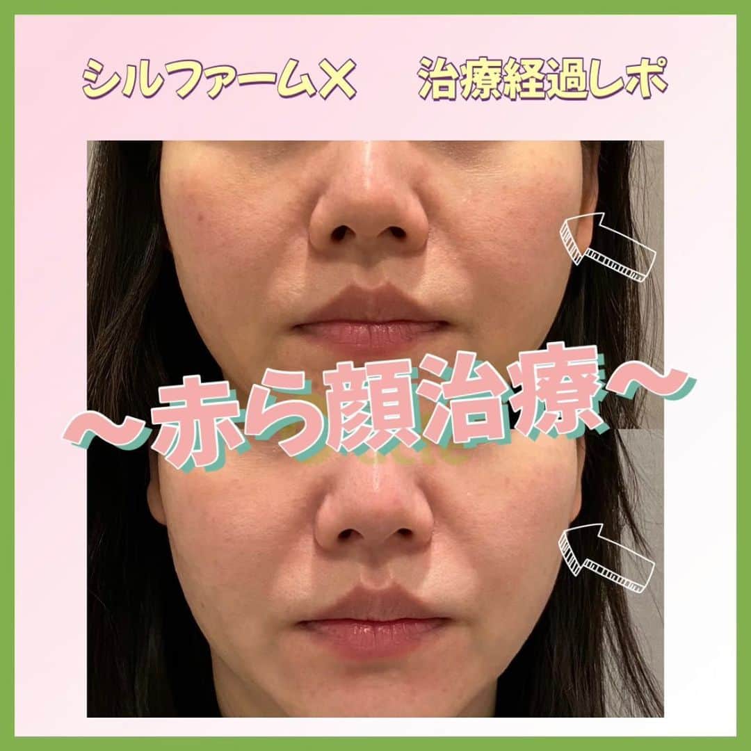 オラクル美容皮膚科東京新宿院のインスタグラム