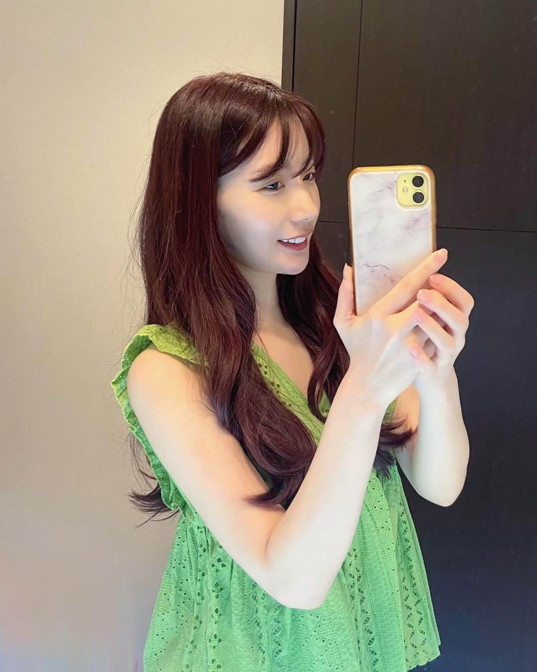 のインスタグラム：「Aclinic @aclinic_shinjuku の戸田先生 @aclinic_toda で1day小顔脂肪吸引受けて来ました❣️ 年々輪郭がたるんでぼやけてきているのがずっと悩みでハイフやエステなど色々試したけど年齢には勝てず…＿|￣|○ 友人がこちらで受けたのを見てこれだ！と受けて来ました😻  脂肪吸引というと痛いし腫れるし、固定バンドを何ヶ月も顔に巻いて圧迫するので大掛かりなイメージでしたが、固定バンドの代わりに糸リフトで固定するだけなので楽チン。 ほとんど腫れもなく固定バンドも必要ないので、術後ステーキ食べたり今日も朝からまるごとバナナも食べてテレビ見て大笑いもでき通常通り過ごしてます☺️  執刀医の戸田先生、カウンセラーさん、看護師さんも皆さん優しくて細かい質問にもたくさん丁寧に答えて頂き安心して手術受けてきました！ 顔を触診しながら若く見えるように取った方がいいところ、取らない方がいいところを丁寧に説明してくれたので戸田先生にお任せしてよかったです☺️  写真は術後3時間後📷 フェイスラインが引き上がって輪郭もはっきりして嬉しい☺️ これから3ヶ月ほどかけてどんどんすっきりしてくるそうなので楽しみに待ちたいと思います🥰 ストーリーに載せたら友人達から詳しく聞きたいとたくさんDMもらったのでまたレポートします！！  #aclinic #aクリニック #エークリニック #aclinic銀座 #aclinic横浜 #aclinic新宿 #美容外科 #美容皮膚科  #1day小顔脂肪吸引 #1day小顔 #脂肪吸引 #小顔 #美肌 #二重あご #フェイスライン  #糸リフト #aスレッド #顔痩せ #部分やせ #小顔整形 #小顔になりたい #横顔美人 #戸田貴之」