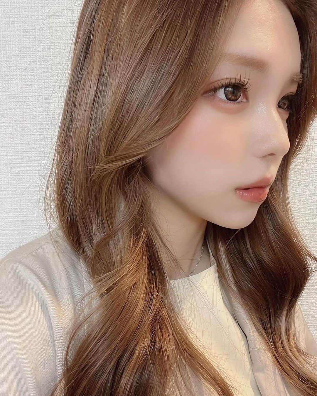 小栁紫苑のインスタグラム：「念願の糸リフト🪡 TikTokで見かけてからずっとしたくてやっとのやっとで @aclinic_shinjuku さんに😊  初めてするけん最初はビクビクしとったけど新宿店のスタッフさんや担当の  @aclinic_toda 先生の気遣いや丁寧さで安心しか無かった🙄 20超えて気をつけとるけどやっぱり体重は増えちゃって1番顔にお肉が付きやすくて 下向いた時の顎と頬のお肉がコンプレックスになってたのに 術後見てみたらもうVラインもくっきりやしたるみが無くなって幸せすぎる（ ; ; ）❤︎ 腫れも一切なかったし麻酔の後は2時間で消えた！痛みもないのがありがたい🫰  BeforeAfterの丸顔たるみとスッキリ具合見てほしい 口角もいっつも書いとったのに自然と上がると！✨  #aスレッド #糸リフト #aclinic  #aclinic銀座 #aclinic横浜  #aclinic新宿  #aクリニック #エークリニック #美容 #小顔 #美肌 #リフトアップ # #美容外科 #美容皮膚科 #美容クリニック #戸田貴之」