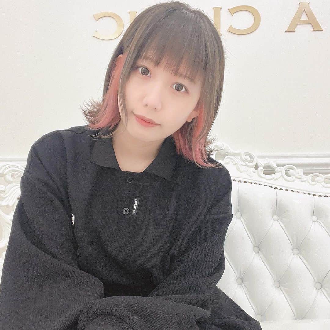橋本からあげのインスタグラム：「꙳ ⁡ @a_clinic_ginza の 木家佑理子先生（ @aclinic_kiya ）に1day小顔脂肪吸引をしてもらった時の経過投稿～🫣 ⁡ 明らかに顔がしゅっとして痩せた？って聞かれること増えた✊🏻 術中は麻酔が効いててぽわっとしてて気づいたら終わってた感じ、目立った腫れもなくて 悩んでたけど受けてよかったなあ〜、って しみじみ思う。悩んでる人いたら勇気出して受けてみるのありかなって思ったჱ̒^._.^） ⁡ 夏が来るから二の腕の脂肪吸収もやりたい！笑 貯金頑張る！笑 ⁡ ⁡ ⁡ ⁡ ⁡ #aclinic #aクリニック #エークリニック #aclinic銀座 #aclinic横浜 #aclinic新宿 #美容外科 #美容皮膚科  #1day小顔脂肪吸引 #1day小顔 #脂肪吸引 #小顔 #美肌 #二重あご #フェイスライン  #糸リフト #aスレッド #顔痩せ #部分やせ #小顔整形 #小顔になりたい #横顔美人 #木家佑理子」