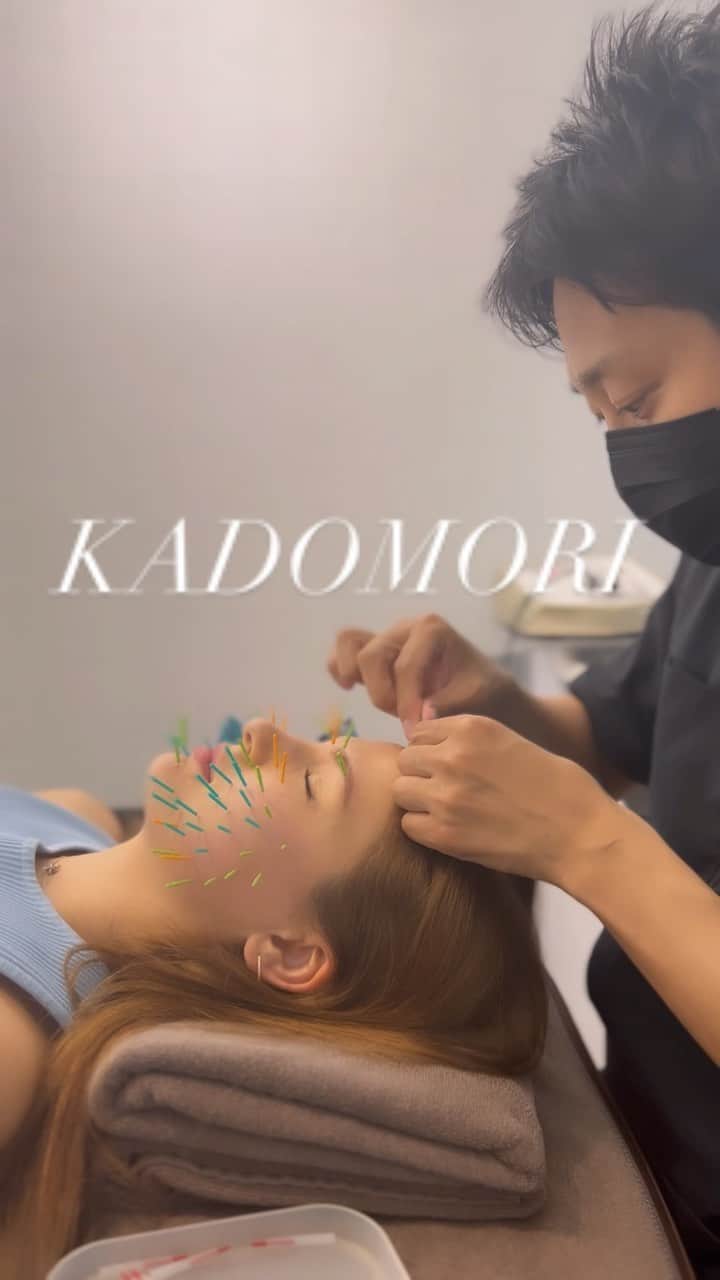 角森脩平のインスタグラム：「Famous acupuncture technique in Japan🤗 .  #kadomori #カドモリ #japanesebeautysalon  #beautyjapantokyo #cosmeticacpuncture  #acupuncturetreatment #osakatrip #japanbeauty #Tokyotrip  #japantrip #Nagoyatrip #Fukuokatrip #ハリネズミ美容鍼 #世界からKADOMORIへ #世界のKADOMORI」