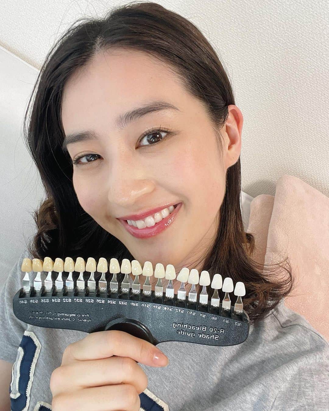 青野楓のインスタグラム：「久々のホワイトニング。 @platinum_beauty_shinjuku にて、プレミアムホワイトニングしました！  一年ぶりだったのでトーン落ちてたけどまたあがった🫡ホームホワイトニングもたまにやるけど痛かったんだよね。 ここのは痛くなかったからまたくる！ 歯が痛いとかき氷🍧たべれなくなるから大事なの。笑  お試しホワイトニング ￥2,970 2回目以降は1回 ￥2,200~￥3,300 らしいです！安いよね🤔  まずはお試しいってみて🦷 #ホワイトニング」