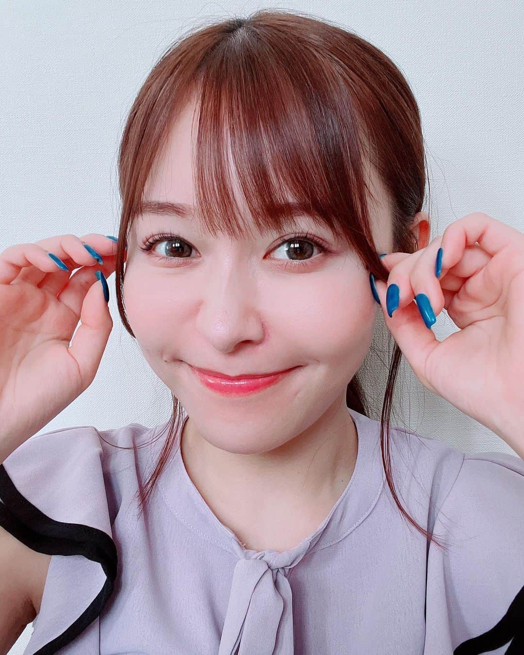 歩乃華（ほのらん）のインスタグラム：「アップ🫣💓 . @a_clinic_ginza の 木家先生 @aclinic_kiya に Aスレッドして頂いてから10日が経ちました🥰 . 術中は怖かったけど腫れもなかったです🥹 施術後からメイクするの楽しい💓 顔のたるみが気になる方は 是非Aスレッド検討してみてください💘  #aスレッド #糸リフト #aclinic #aclinic銀座 #aclinic横浜 #aclinic新宿 #aクリニック #エークリニック#美容 #小顔 #美肌 #リフトアップ #美容外科 #美容皮膚科 #美容クリニック #木家佑理子」