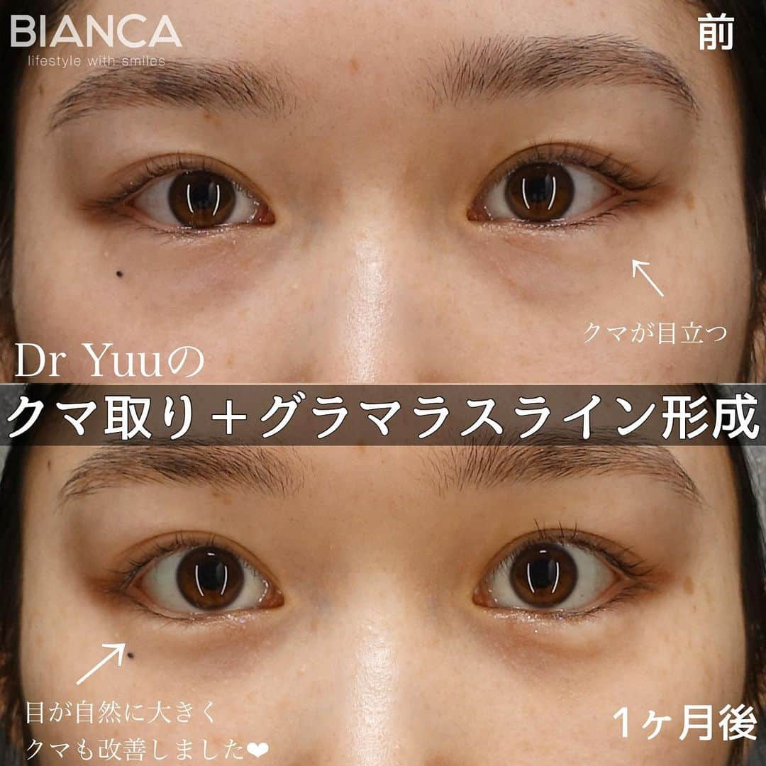 辻沢由有（BIANCA CLNIC 表参道院 院長）のインスタグラム