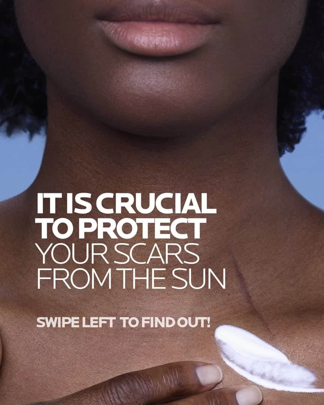 のインスタグラム：「If you’re enjoying some warm summer weather, beware of the sun when wanting to protect your scars.   Swipe across and reassure yourself with these helpful reminders. 👉  All languages spoken here! Feel free to talk to us at anytime.  #larocheposay #sunprotection #anthelios #cicaplast  Global official page from La Roche-Posay, France.」