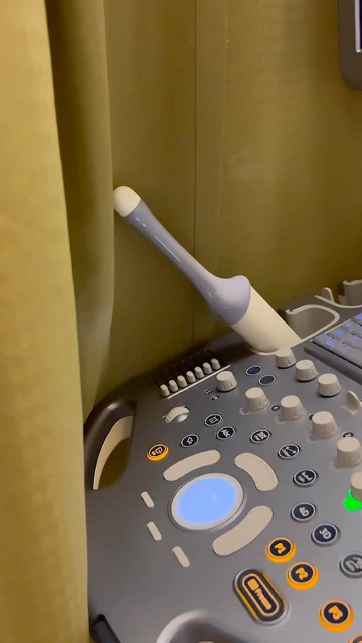 Peta Murgatroydのインスタグラム：「A very up close and personal ultrasound appointment 🤣 Meet my follicles guys 🙋🏼‍♀️ @maksimc was only slightly traumatized by some “tools”! VOLUME UP 🗣  Sorry in advance @drmarksurrey for our immature humor 😬🤣」