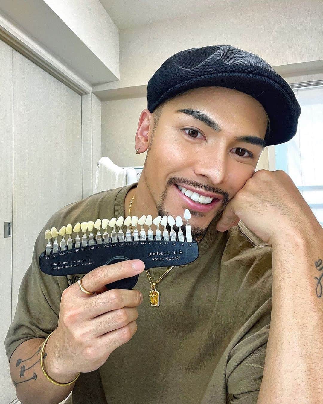 ARU【アル】のインスタグラム：「@light_beauty_kinshicho でホワイトニングしてきました！ 久しぶりにサロンホワイトニングしたけどやっぱり即効性があって効果も目に見えるからとてもいいですね👌」