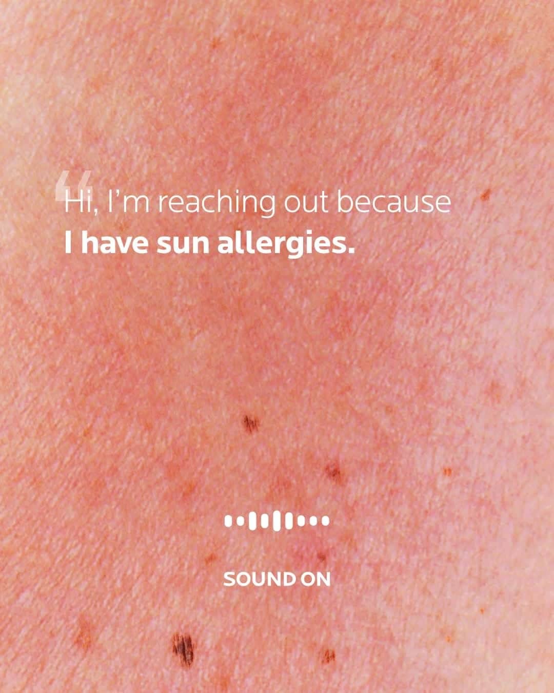 のインスタグラム：「Summer can be the best season of the year for a lot of us but for some people, it is a nightmare. ☀️ Rednesses, red spots, papules, itching & burning sensations - this is sometimes the life of people with sun allergies.   Today, we want to share a powerful testimony about this skin condition. Thank you so much for opening up and sharing your skin story with our community. Here’s what we advise you to do:   1️⃣ Apply a high SPF sun protection such as Anthelios UVMune 400, to protect your skin against the most insidious UV rays.  2️⃣ Wear a hat and clothing if it is sunny outside to protect your face from direct sun exposure.  3️⃣ Your skin is sensitive & reactive, so why not try Toleriane Dermallergo to soothe and hydrate your skin daily.  4️⃣ If you already have some irritations, try Cicaplast Baume B5 after sun exposure to soothe and repair your skin.  5️⃣ If you think you have this type of skin condition, consult a dermatologist.   We hope these tips helped a little, in any case, it is crucial to have a medical opinion to better treat your skin condition. 💪  Do you also want to share your skin story? Send us a vocal @larocheposay with #speakout; we would love to hear from you and help!   All languages spoken here! Feel free to talk to us at anytime.  #larocheposay #sunallergies #sunprotection #anthelios #toleriane #cicaplast #speakout   Global official page from La Roche-Posay, France.」