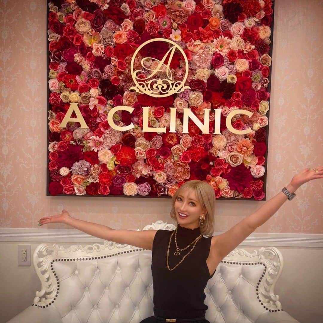 のインスタグラム：「@aclinic_shinjuku の  戸田先生 @aclinic_toda に Aスレッドをしてもらってきました⸜🙌🏻⸝‍  ここ１年ほど頬のたるみやほうれい線が悩みで… でも糸リフトって痛くてそれぼど引き上がる イメージがなくて避けてきたのだけど `A clinicはめちゃくちゃ上がるし痛くない´ って前から噂で聞いてはいたので、ついに決意!!✊🏼  実際受けに行って、麻酔がまず怖かったけど 笑気麻酔でふわふわしてる間に 局所麻酔も一瞬だったし、糸(針)入れるのも 気づいたら終わってたレベル😳 この痛みに弱い私でも大丈夫でした🫶🏽✨️  その後糸引っ張るんだけど ぎゃんぎゃんに上げてくれたから ほうれい線どこ！？て感じで実感がすごい👏🏽 頬のぽよんもどっかいったﾄﾞｺ(･ω･≡･ω･)ﾄﾞｺ もう大満足(;´༎ຶٹ༎ຶ`)💯♥️  担当してくれた戸田先生は カウンセリングめちゃくちゃ丁寧だし的確で、 質問への返答も迷いのない感じが とても信頼感と安心感の塊でした✨️ しかも女子は喜ぶやまぴー似のいけめんだよ🤤←  院内もとても清潔感あって綺麗でオシャレ〜🧚🏽‍♂️✨️ 受付の方もカウンセリングしてくれたお姉さんも 優しいし丁寧だしにこにこしてて本当に良かった🥰  興味ある人は迷わずカウンセリング受けるべき。  私もHP見たら眉下リフトとメーラーファットも 気になり始めたからまた聞いてみようと思う😙  #aスレッド  #糸リフト  #aclinic #aclinic銀座 #aclinic横浜 #aclinic新宿 #aclinic名古屋 #aクリニック #エークリニック #美容 #小顔 #美肌  #リフトアップ  #美容外科  #美容皮膚科  #美容クリニック #戸田貴之」