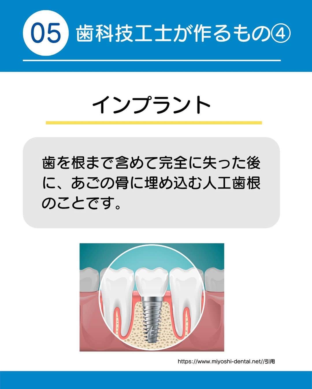 新東京歯科技工士学校さんのインスタグラム写真 - (新東京歯科技工士学校Instagram)「@shintokyodental ※保存しておくと後で見返せます。  高齢化社会の今、歯科技工士の仕事は今後ますます重要になってきますね。  現状、歯科技工士の若者層が少なくなっているということは、しっかりと技術を身につければ、引くてあまたな存在になれる可能性はぐんと高くなります。  もっと新東京歯科技工士学校のことについて詳しく知りたい方は、LINE登録していただくと、  気軽にパンフレットを見たり、進路選択に役立つ情報を得ることができたりするので、ぜひ、ご活用ください。  ＊＊＊＊＊＊＊＊＊＊＊＊＊＊＊  このアカウントでは  新東京歯科技工士学校のこと、歯科技工士の仕事のこと、学生のリアルな情報をお届けしています。  質問などありましたら、お気軽にコメント、𝖣𝖬ください☺︎  ぜひフォローしてください！(@shintokyodental)  ＊＊＊＊＊＊＊＊＊＊＊＊＊＊＊  #歯科技工士 #歯科技工 #歯科技工士の卵 #歯科技工士あるある #歯科技工士のつぶやき #歯科技工士専門学校 #歯科技工士国家試験 #歯科技工士募集中 #歯科技工士科 #歯科専門学校 #新東京歯科技工士学校 #マウスガード #矯正装置 #インプラント技工 #入れ歯deスマイル #笑顔をつくる #笑顔をつくるお手伝い #笑顔をつくる学校 #笑顔をつくるお仕事」9月1日 22時18分 - shintokyodental