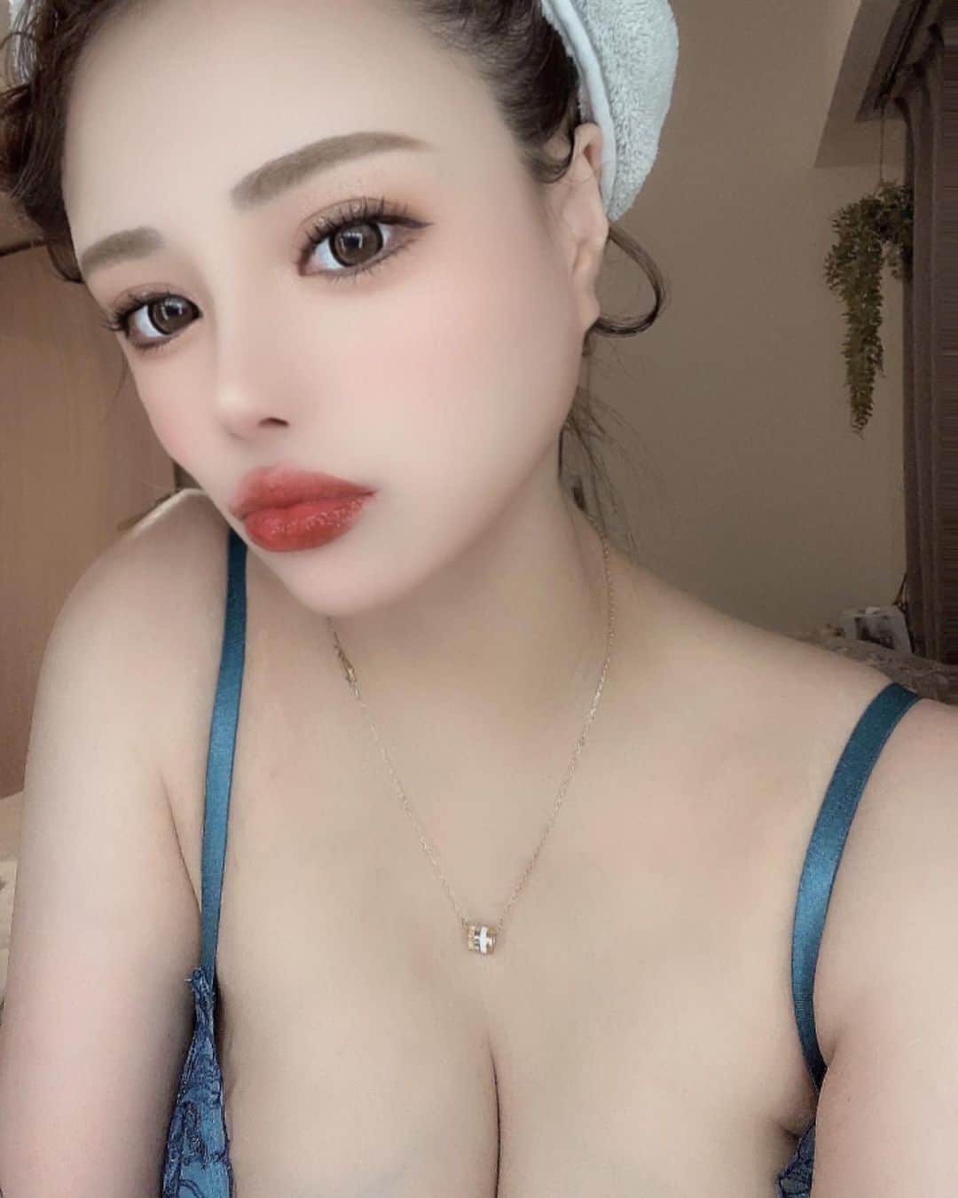 咲月朱音のインスタグラム：「鼻をストレートかアップノーズにするか悩んでますが アップノーズのがいいのかな🥹ておもいだした(幼くみえるかな🤔)  どう思いますか😭  #整形 #鼻中隔延長 #鼻整形 #ダウンタイム」