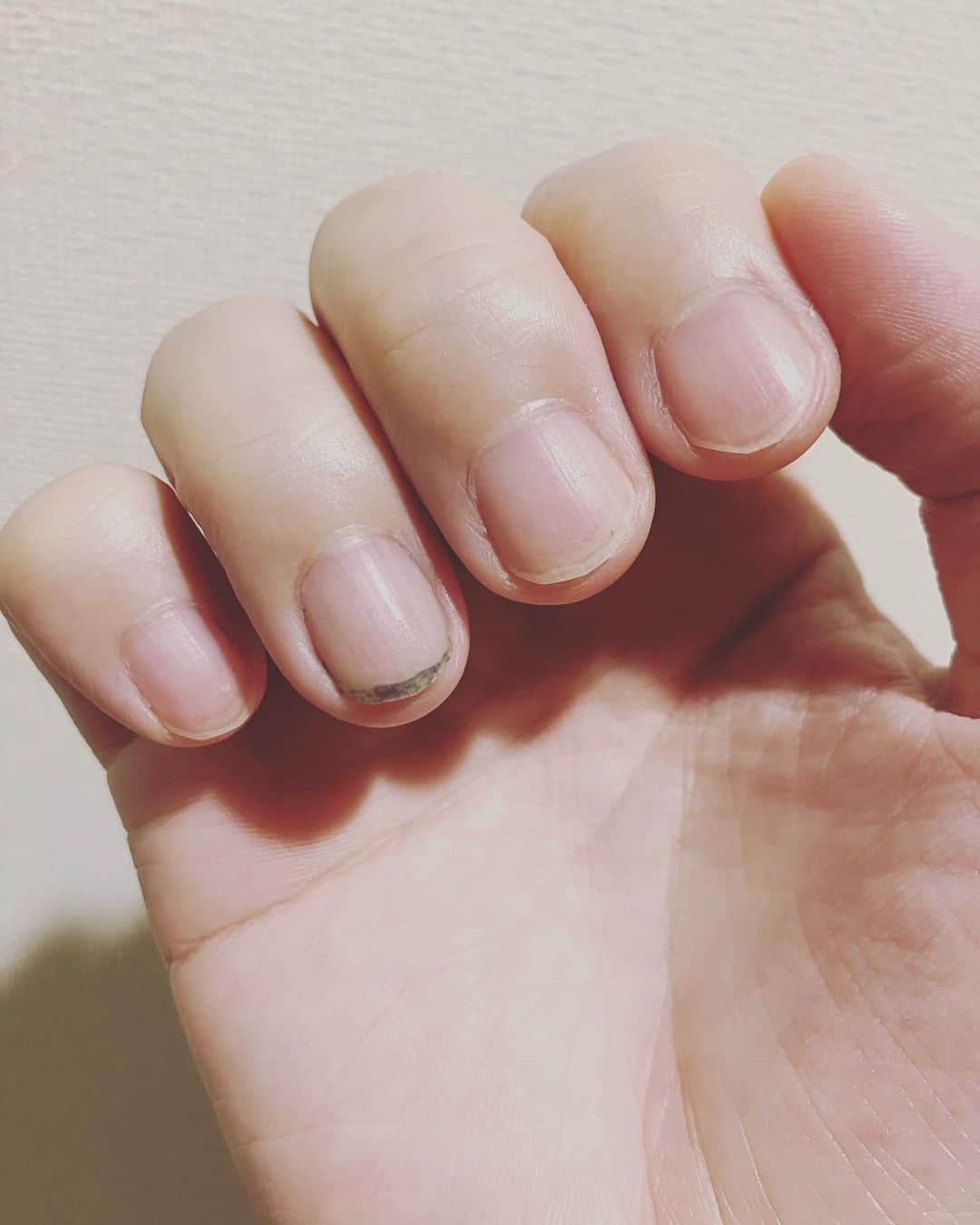 木村良平さんのインスタグラム写真 - (木村良平Instagram)「イカスミを使った翌日の指は、いつもこう。 #美味しかった #イカスミ好き？」9月3日 15時05分 - ryouhey_drunk