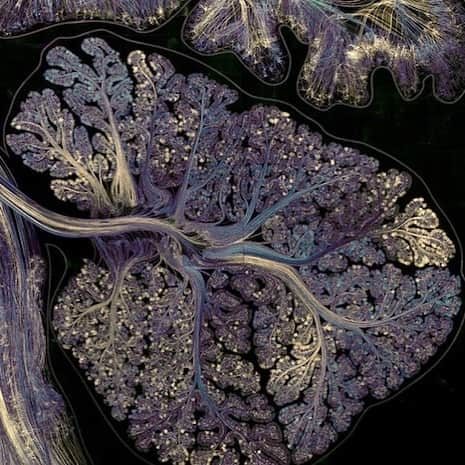 Sarahのインスタグラム：「I recently did an MRI scan while on and off psilocybin to discover how the brain shifts and changes depending on what genre of music you’re listening to. What do you think the results were?」