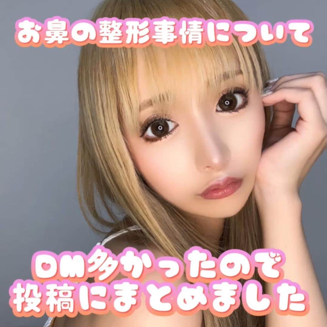 黒宮ちはやのインスタグラム：「🏥 @the_roppongi_clinic  🧑‍⚕️ @dr.shinji_nagao 先生  ちなみに、ちゃんと自分で調べて 見つけてお金もしっかり払ってます！💸  決め手は、 ☆元々生まれ持った鼻中隔の湾曲を修正した方がいいと提案をしてくれたこと (色々カウセ行ったけど、初めてその施術を提案してもらった)  ☆術前も含めアフターケアが超超しっかりしてるとこ💊  ☆すごく丁寧に時間をかけてカウンセリングしてくれたこと 分からないところや気になるところ不安なところ全部全部質問できました  ☆必要、不必要な施術を言ってくれるだけでなく、 現時点(手術前)の鼻の状況も色々教えてくれたこと👃  もう勝手に信頼しきってますw  左右非対称すぎて特に左斜めから見た鼻が鷲鼻にみえて凄く嫌で、 2年近くずっと良い先生探してて気になったらカウセ行っての繰り返しだったんだけど、 長尾先生を見つけて、カウセ行って 即決断した😎✌️  色んな整形してきたけど仕上がりがこんなに完璧で感動したのは 私史上まじで初めて！😎🤣✨  てことで可愛くなりたいカッコよくなりたい皆様に情報おすそわけ(￣^￣)ゞ   #黒宮ちはや #小悪魔ageha #モデル #キャバクラ #キャバ嬢 #ホステス #ラウンジ #水商売 #お酒 #歌舞伎町 #新宿 #六本木 #銀座 #北新地 #ミナミ #華灯 #theroppongiclinic #長尾真治 先生」