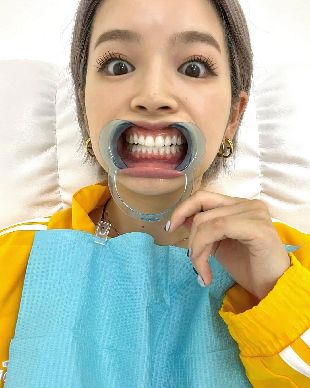 富久美玲のインスタグラム：「_ . お久しぶりのホワイトニング🦷✨ . 合法的に海外の最新溶剤が使えるお店で たった1回でも圧倒的効果！！！ . #whitening#ホワイトニング#セルフホワイトニング#tokyoswrs」