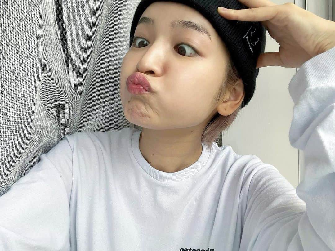 富久美玲のインスタグラム：「_ . 今回ついに・・・！ . 鼻にあったソバカスとおさらば👃👋 . 1枚目▷施術後1週間経った今日！ 写真では分からない程に薄くなりました🥺  2枚目▷施術前  3枚目▷施術後(赤くかぶれました)  4枚目▷施術後3日が経ったぐらいから 赤みとかぶれも引いたのと同時にポロッと ソバカスが取れて薄くなってました✨ . 施術内容は フォトフェイシャルのルメッカ ➕高濃度ビタミンC点滴 . 担当:工藤ナース . #表参道メディカルクリニック#フォトフェイシャル#ルメッカ#高濃度ビタミンC点滴」