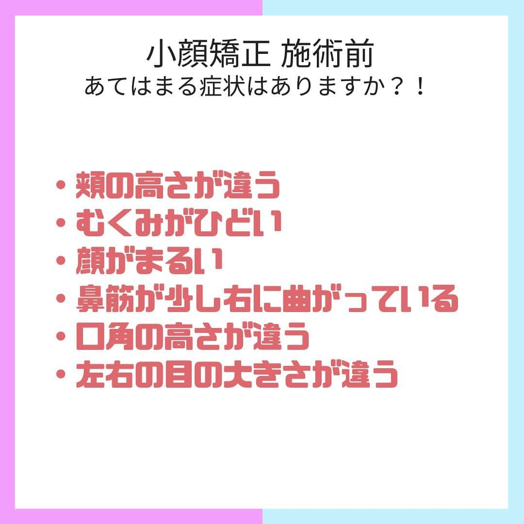 小顔.小顔矯正.Speed小顔公式アカウントさんのインスタグラム写真 - (小顔.小顔矯正.Speed小顔公式アカウントInstagram)「スピード小顔の小顔矯正「#筋膜に働きかける整体」です。  筋膜とはそもそも筋肉を覆っている膜のこと。  体全体が筋膜でつながっているので、ある部分の筋膜に障害が出ると離れた関係のなさそうな部分にも影響を及ぼしてしまうことがあります。😭  筋膜が凝ったり、歪みや捻れが生じると、 必然的に筋肉も引っ張られ、顔が歪んだり、たるんだりしてしまうんです。  そこで、筋膜が歪んでいる部分を探し、優しく調整しながら 引っ張っている部分を緩めることで骨の歪みを取り除いていきます。  筋膜が正常に戻ることで筋肉や骨が本来の位置に戻り、正しく機能するようになります✨  筋膜に働きかけ、詰まりがとれることでリンパの流れもよくなりますし、顔だけでなく、 顔の歪みに影響する頭蓋骨や体全体の歪みも整えるので効果が長続きするのも特徴😊  回数を重ねるごとに、 筋膜や筋肉、骨なども正しい位置を覚えて行くのでより持続力も長くなります。  老廃物も流れやすく、血流も良くなるので ✅肌ツヤも良くなる ✅目の下のクマも改善される  きれいな #フェイスライン や #美肌 で愛され小顔をゲットしたい方に朗報です👇  ▶︎▶︎お得な情報◀︎◀︎ 100円ハイフキャンペーン実施中！ ご予約は、プロフィール欄「スピード小顔®️公式」からお待ちしています。 ------  まだ、スピード小顔を体験したことがない皆様もお気軽にお越しください☺️ 心よりお待ちしています❤️  #スピード小顔 #speed小顔 #骨からキレイに #モテ小顔 #愛され小顔 #コガオアディクト #4D小顔 #小顔 #小顔矯正 #ダイエット #むくみ  #小顔マッサージ #美容女子 #ハイフ #HIFU #たるみ改善 #美容整骨 #小顔メイク #小顔になる方法 #顔痩せ #顔の歪み #顔のむくみ #エラ矯正 #セルキュア #ハイフ小顔」10月18日 8時54分 - speedkogao