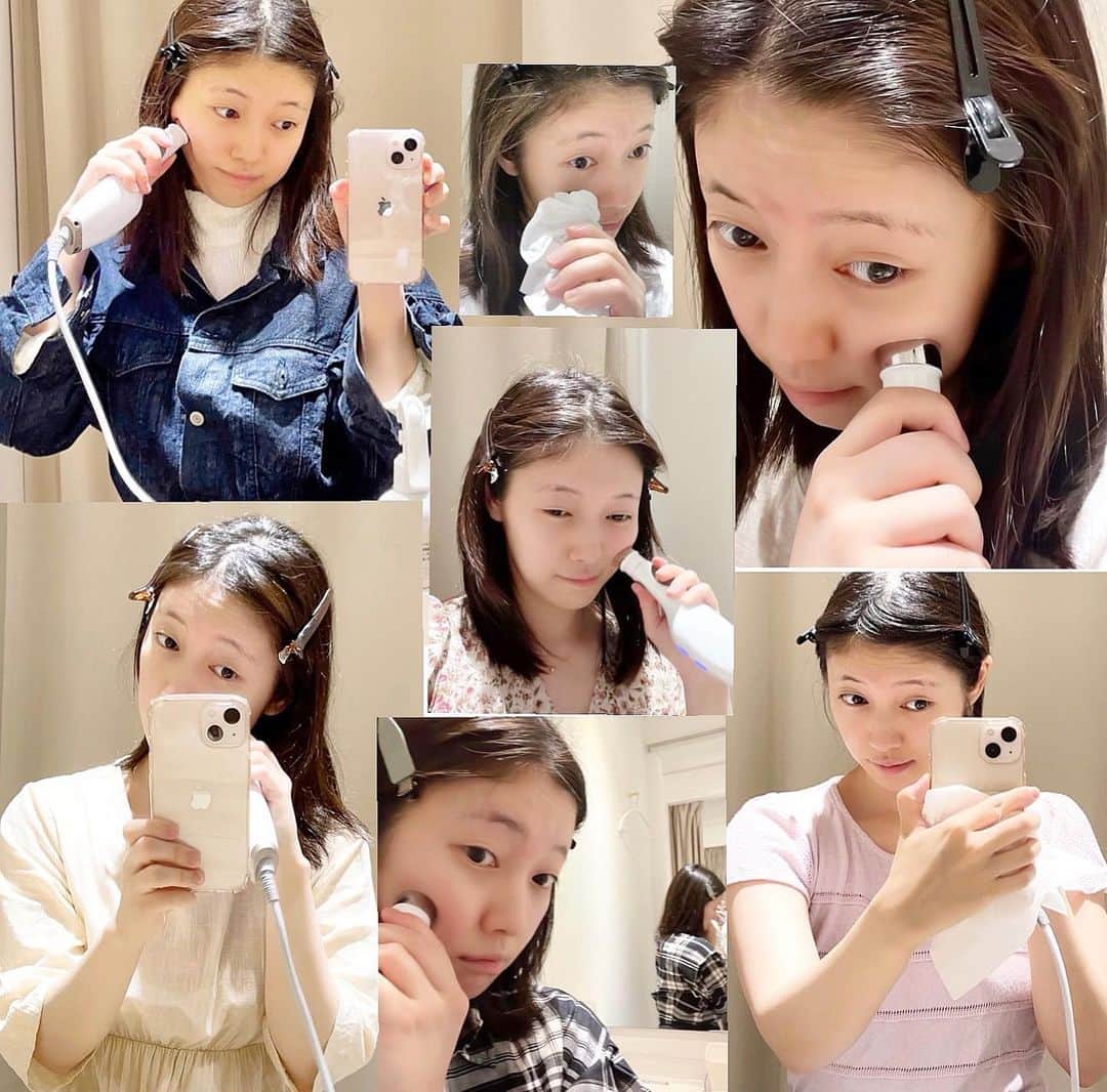 畑山亜梨紗のインスタグラム：「かよったよ💆‍♀️美容皮膚科だよ🌱  ありさ。」