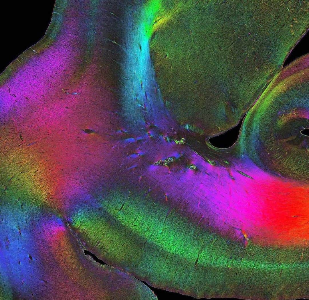 Sarahのインスタグラム：「Temporal lobe 🪷 🧠」