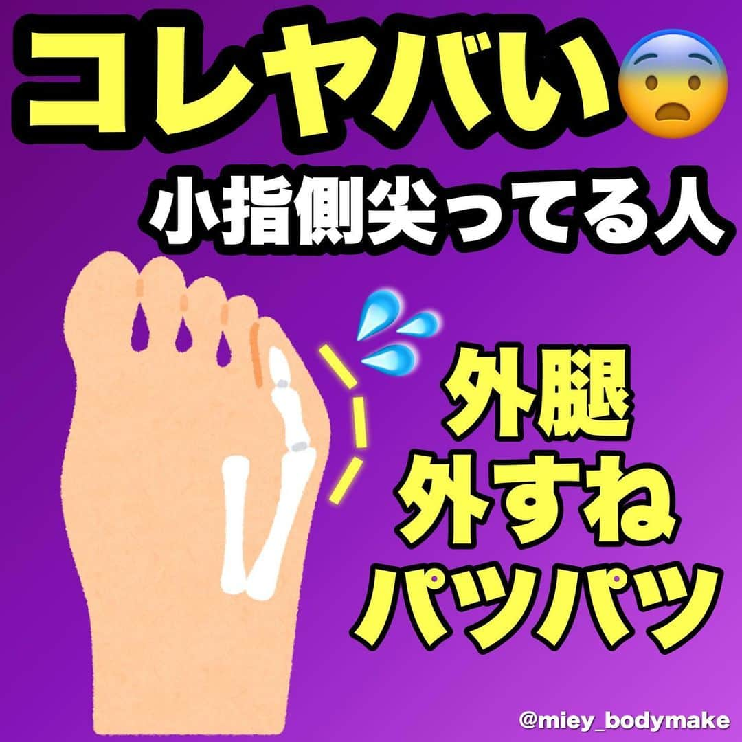 mieyのインスタグラム：「保存してまたやってね！  こんばんは！  日頃、毎日レッスンをしていると、 色んなタイプの体を見ることができるんですが  ✅股関節が硬い ✅足首が硬い ✅外腿張ってる ✅前もも張ってる ✅脛が張っててバナナふくらはぎ🍌 ✅O脚、XO脚 ✅膝や股関節痛を抱えやすい ✅何しても脚だけ痩せない  上記から2つ以上当てはまる という方の共通点は、  立つ時、歩く時に小指側に体重をかけているという事です！  土台から整えることが美脚の近道ですから、 是非寝る前のマッサージとして取り入れてみてくださいね！！  マッサージ直後は、脚がびっくりするほど軽くなって、 翌朝はびっくりするほど見た目がすっきりします！  本当に騙されたと思ってやってみてほしい🥺  💎リアル・オンラインレッスンは↓↓↓ @pilates_alim   👗日常・食事・私服サブ垢↓↓↓ @miey_alcoholfree   #内反小趾 #外反母趾 #ふくらはぎ痩せ #脚痩せ #太もも痩せ #O脚 #o脚改善 #x脚 #ダイエッターさんと繋がりたい」